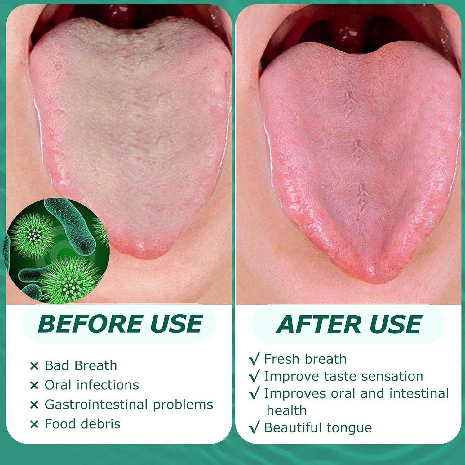 Raspador de lengua, limpiador de lengua de acero inoxidable, raspador de lengua para adultos, reduce el mal aliento y el aliento fresco (1 paquete