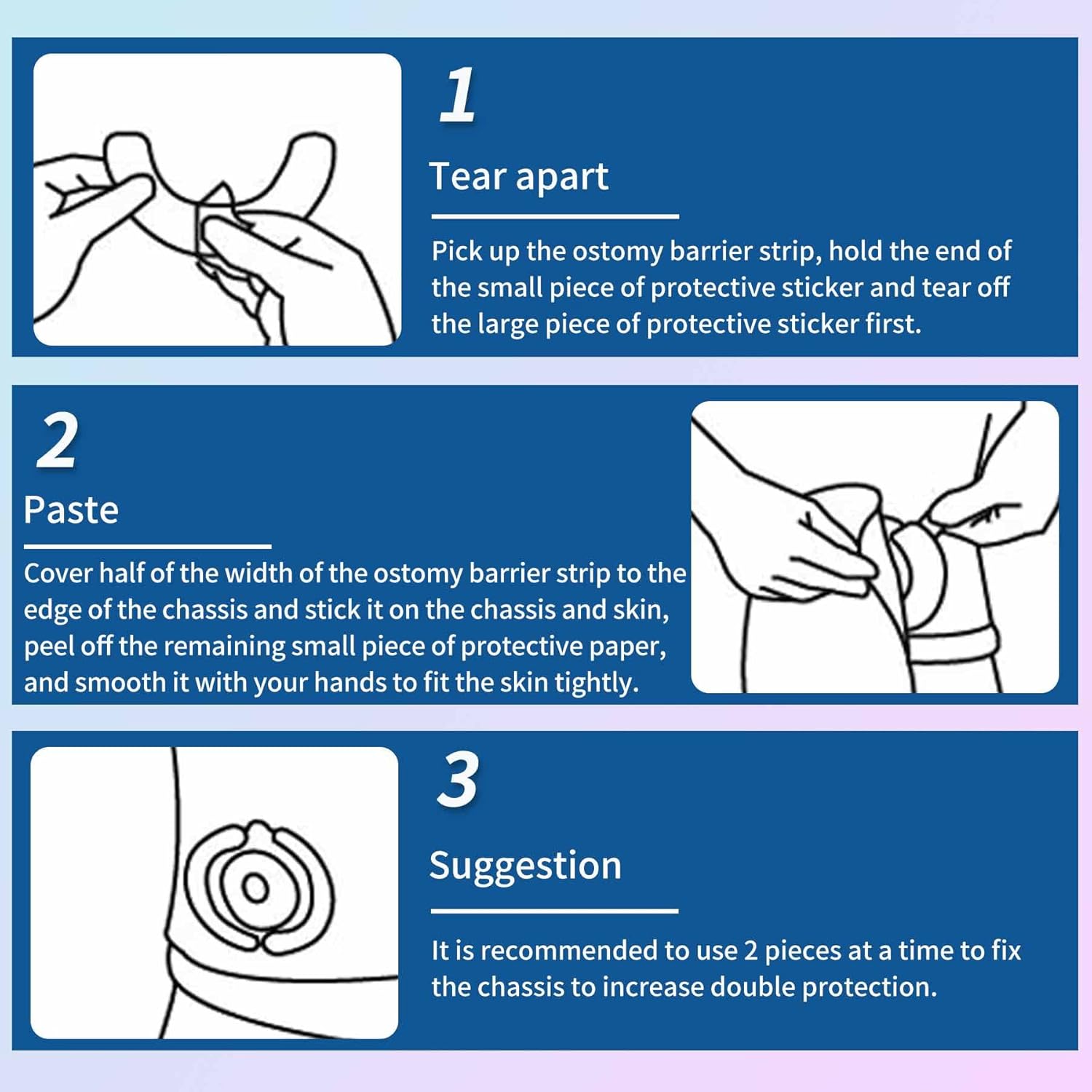 Tiras de barrera para ostomía, suministros de ostomía, tira elástica de barrera para la piel, extensores de cinta de barrera para ostomía para