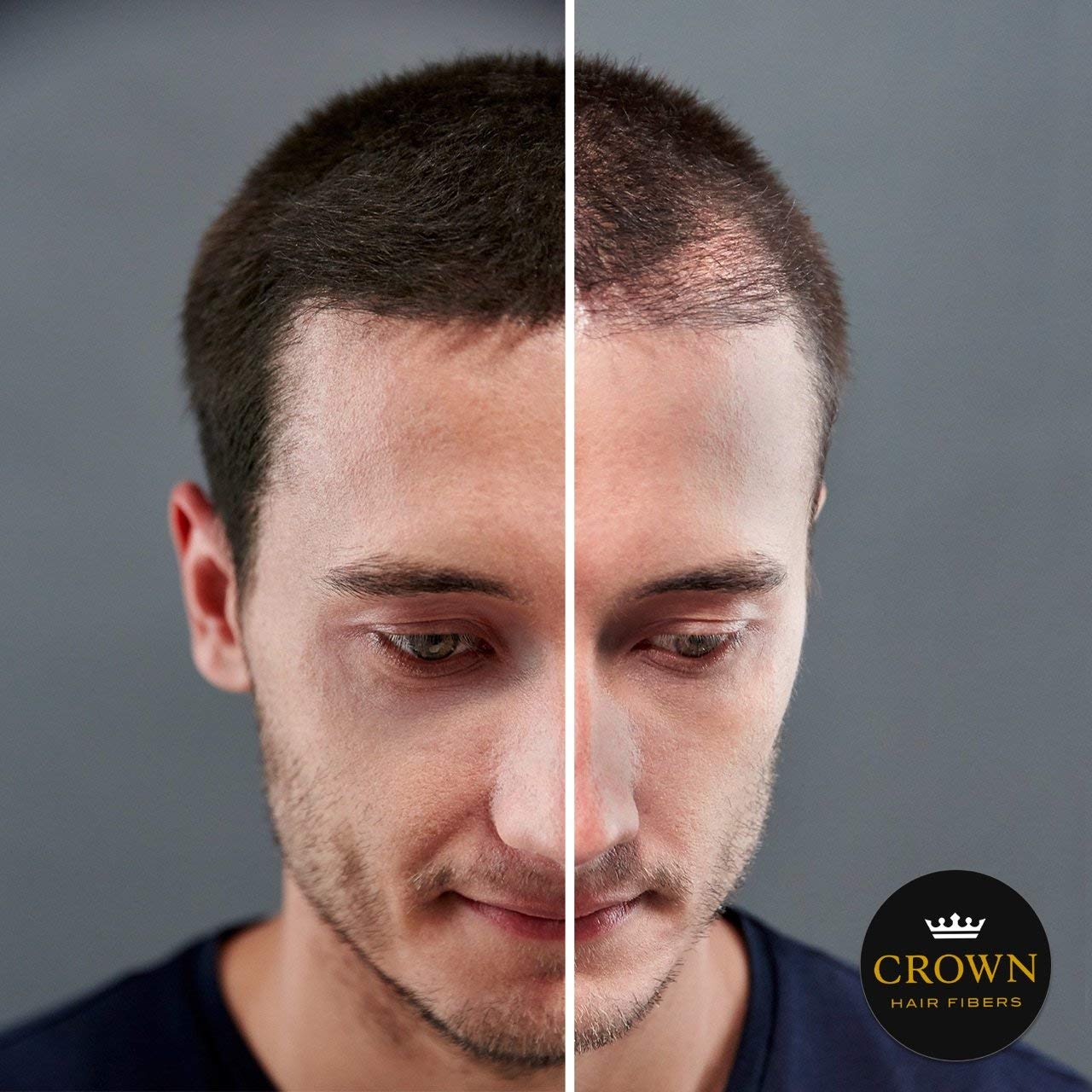 para cabello adelgazante (GRAY)  Espesa instantáneamente el cabello adelgazante o calvo para hombres y mujeres  Botella de 0.87 oz25 g  El mejor