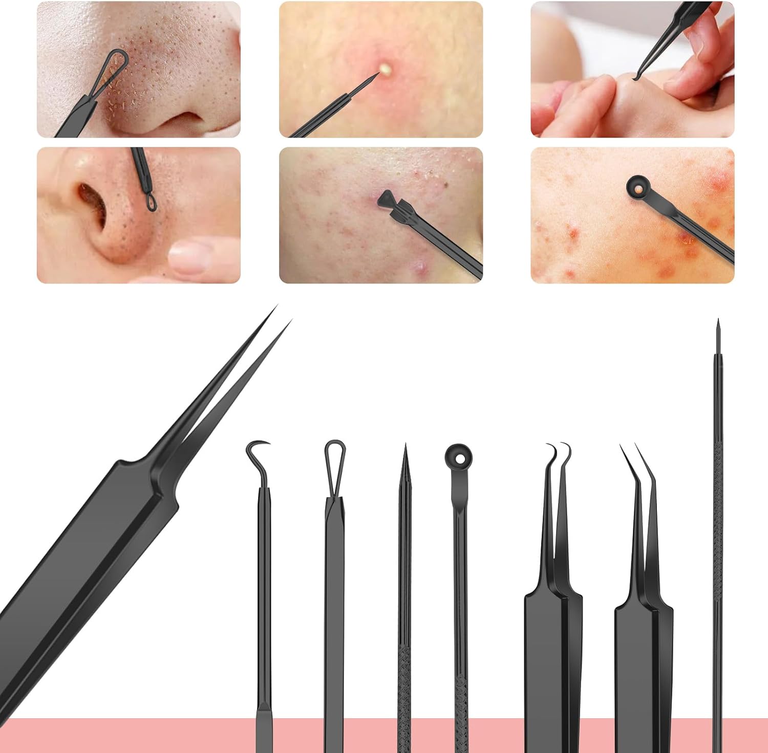 Removedor de puntos negros, 8 piezas de acero inoxidable, kit de herramientas de eliminación de manchas de puntos blancos, extractor de comedones