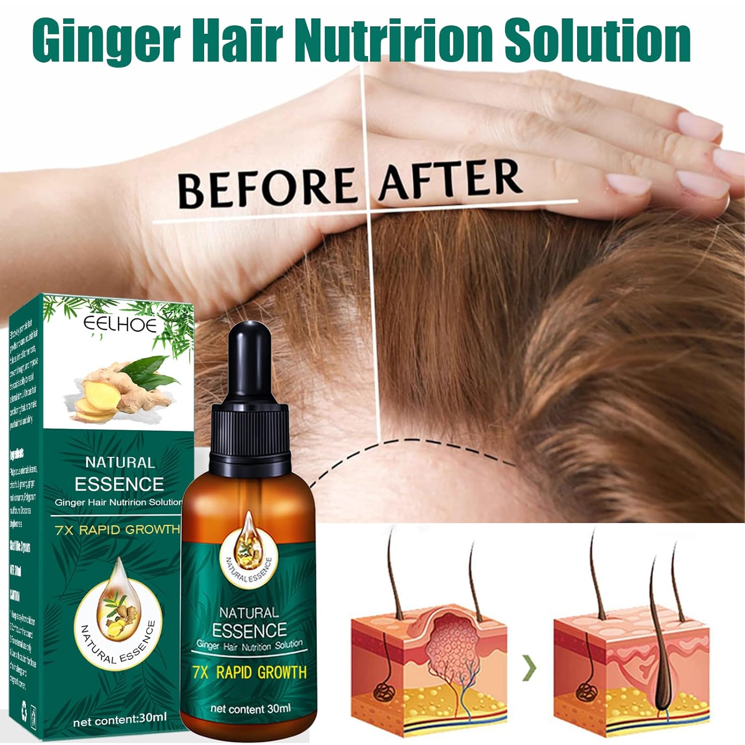 Natural Essence – Solución nutricional para el cabello de jengibre, suero de crecimiento del cabello líquido para pérdida de cabello con esencia de