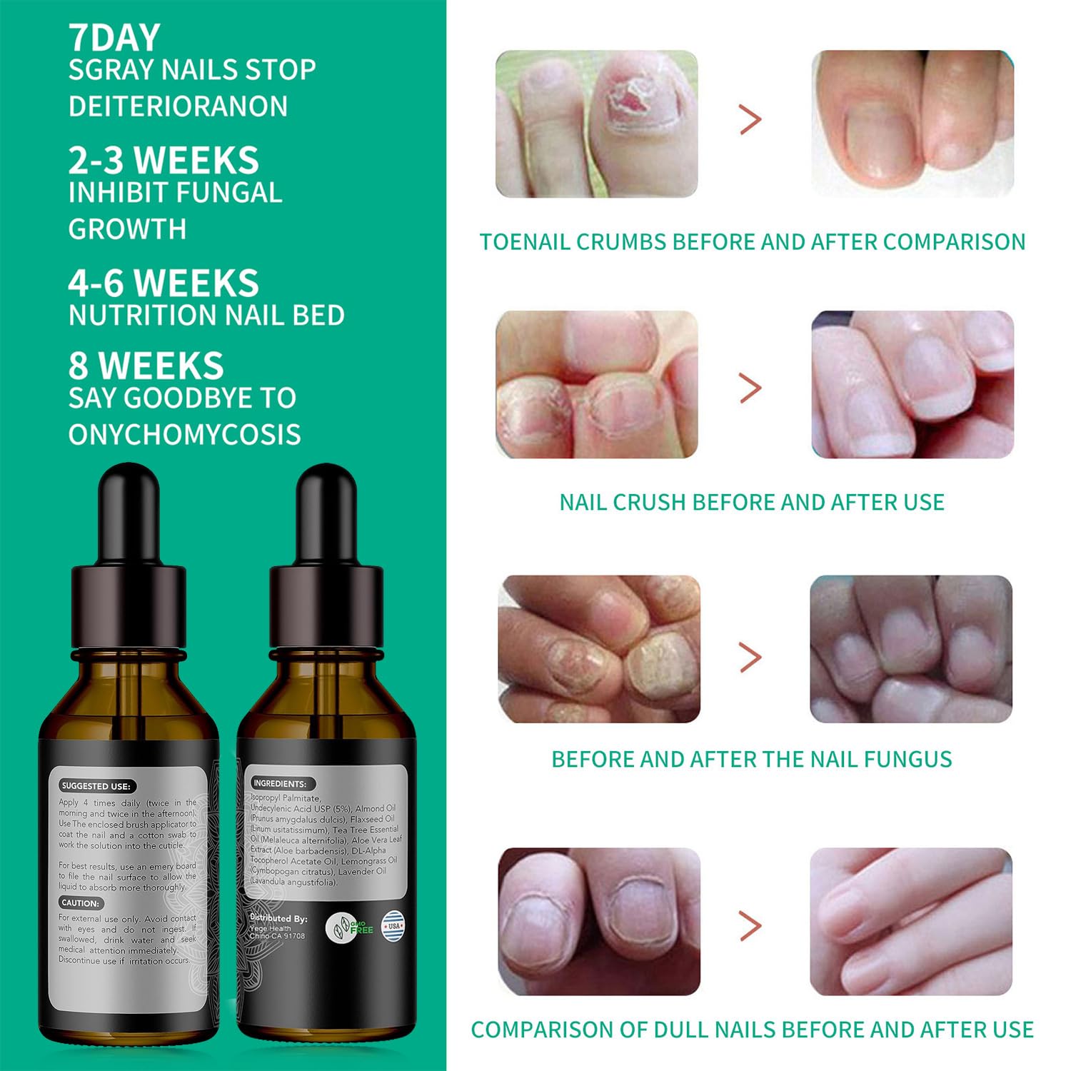 Tratamiento de uñas de metanail, tratamiento de crecimiento de uñas para tratamiento de uñas de los pies, extra fuerte para reparar uñas dañadas y