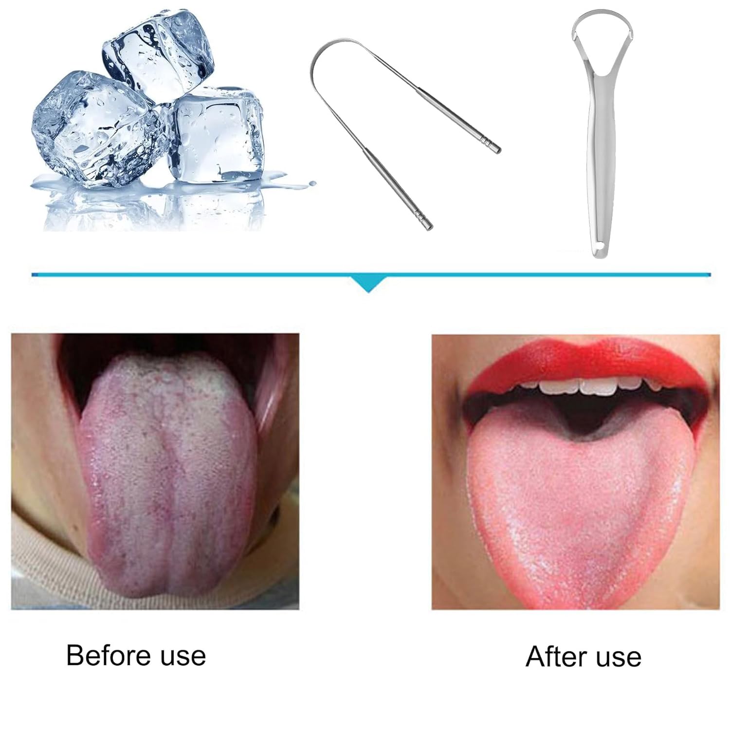 Raspador de lengua, paquete de 2 limpiadores de lengua de acero inoxidable, raspador de lengua para adultos, reduce el mal aliento y el aliento