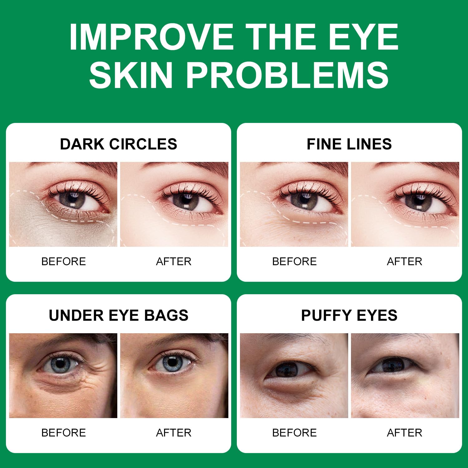 ROUSE Parches de algas verdes para debajo de los ojos, máscara de colágeno con algas marinas para bolsas debajo de los ojos, ojeras, almohadillas de