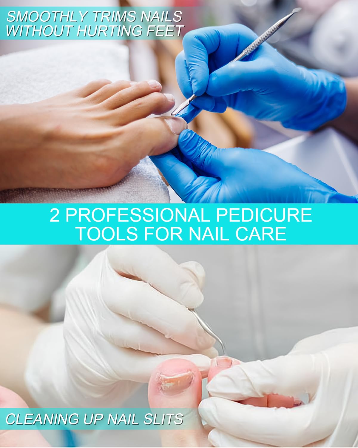 Herramienta de tratamiento de corrección de uñas encarnadas, 60 parches correctores de uñas encarnadas en 2 tipos, herramienta profesional segura
