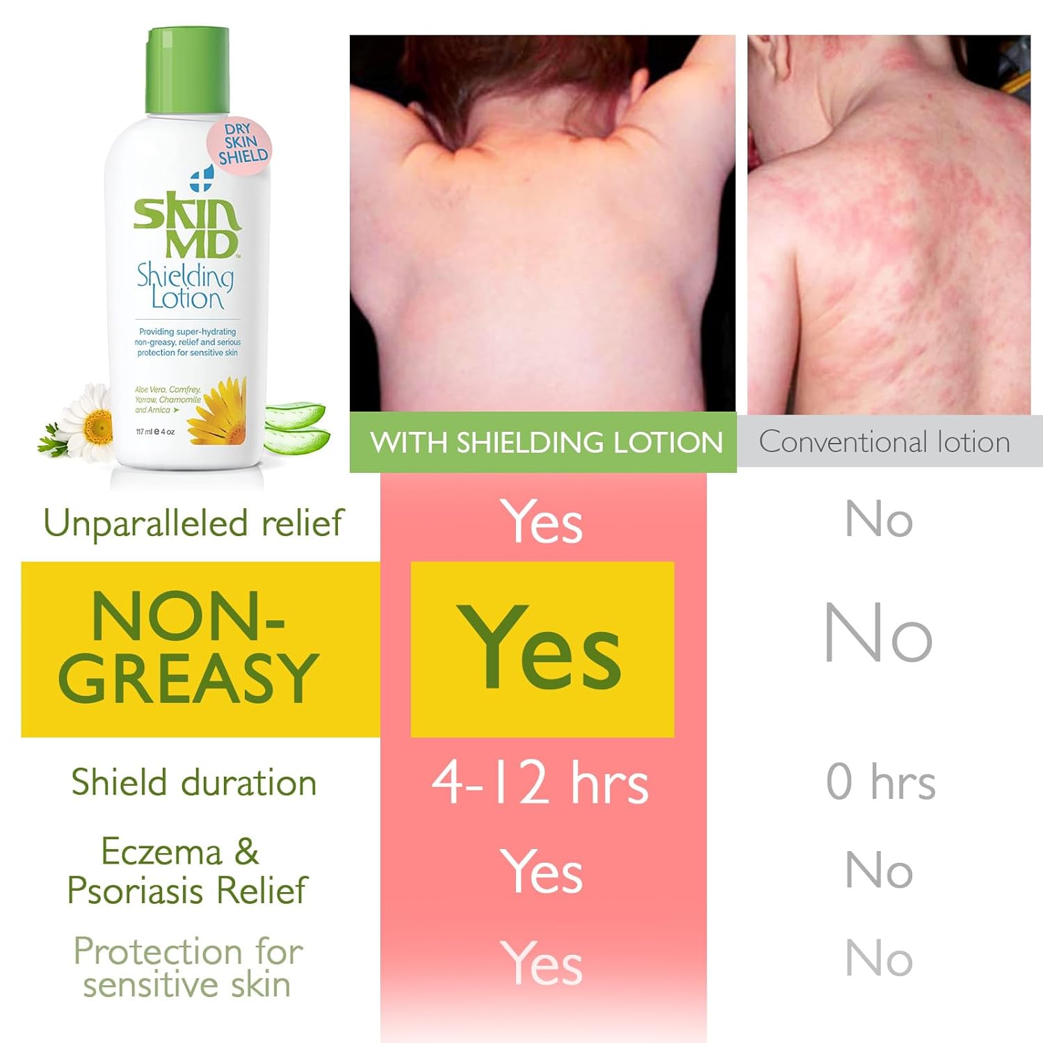 Loción protectora natural para la cara Skin MD, cuerpo y manos, ayuda con eczema y psoriasis El remedio natural a las cosas que secan tu piel