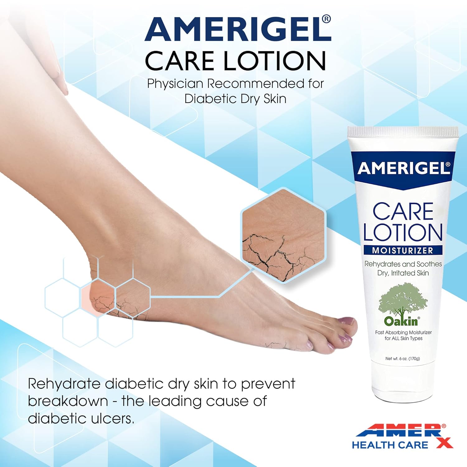 AMERIGEL Paquete de loción para el cuidado  Hidratante hipoalergénico (6 onzas) que rehidrata y calma la piel seca  Loción de cuidado para el