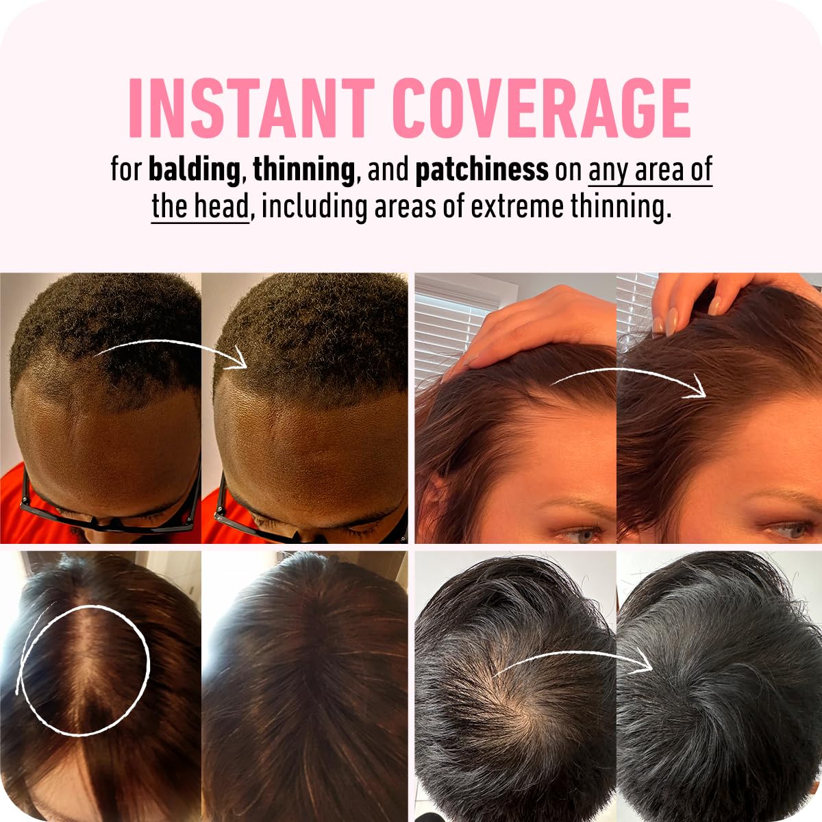 BOLDIFY Polvo de línea capilar  Botella más grande de 0.35 oz  Polvo de retoque de raíz  Oculta instantáneamente la pérdida de cabello  Toppers para