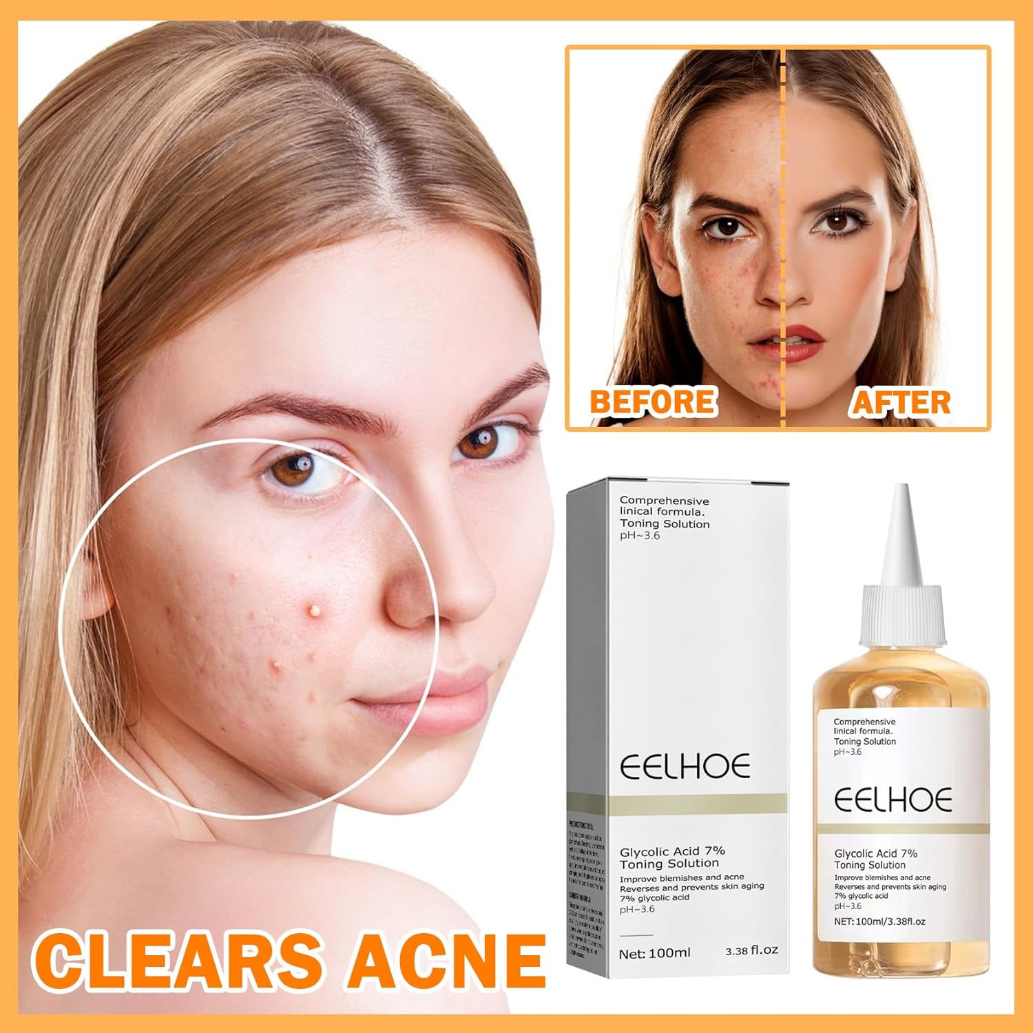 Solución de rejuvenecimiento tonificante de ácido glicólico de 3.4 fl oz, exfoliación facial de poros de ácido glicólico al 7 %, rejuvenece tu piel,