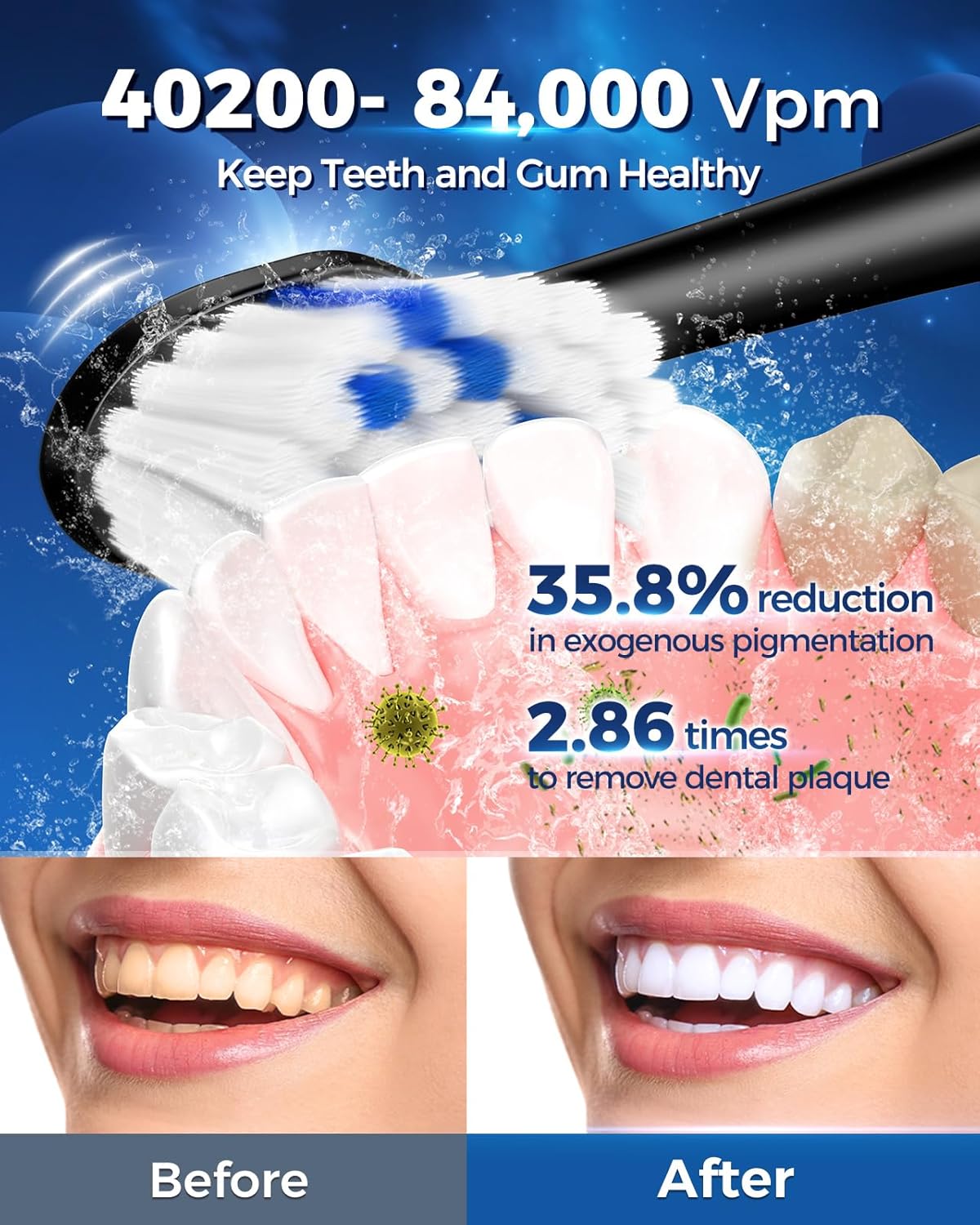 Cepillo de dientes eléctrico para adultos con 6 modos y 5 niveles de intensidad, cepillo de dientes sónico de 84000 rpm con cabezales de cepillado