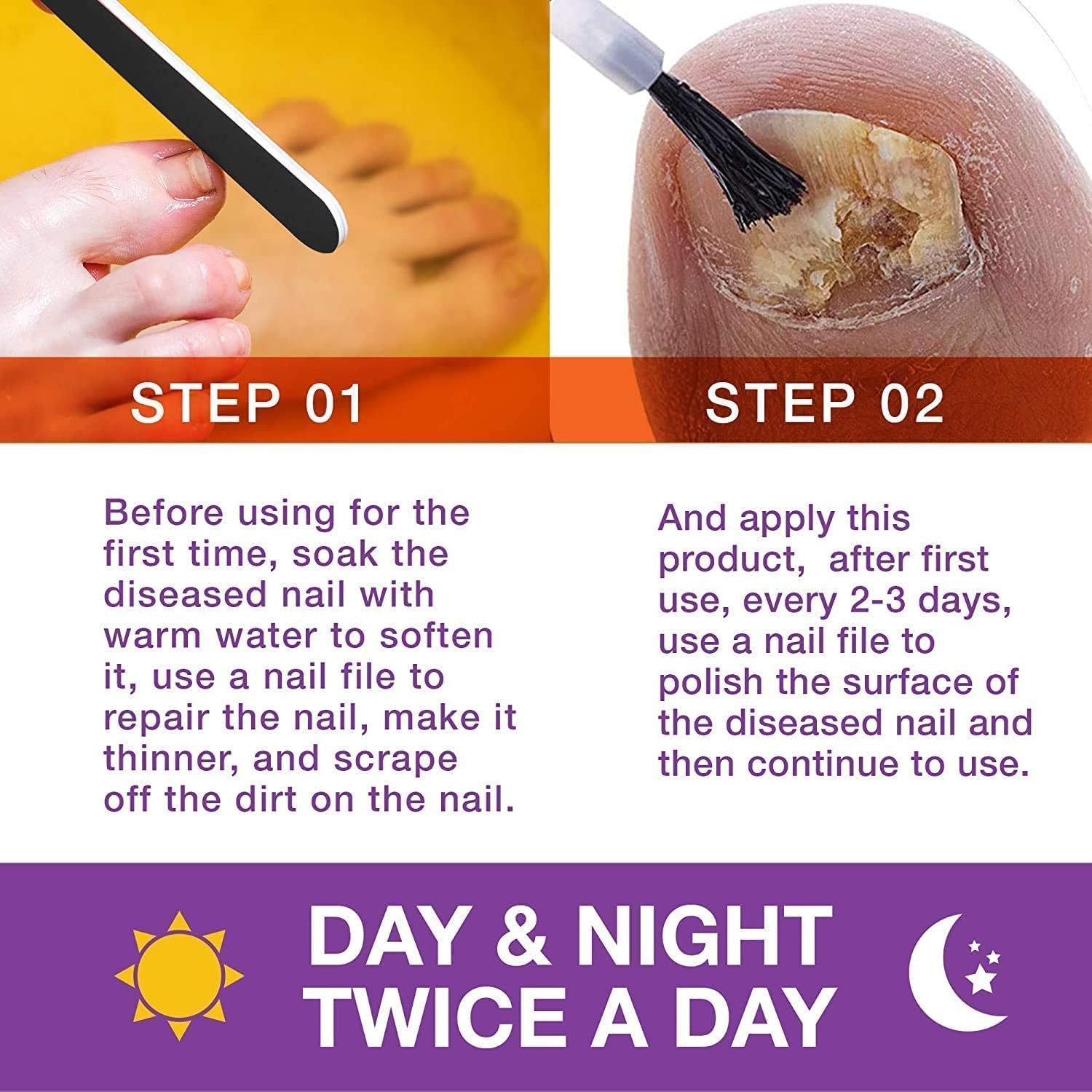 Tratamiento de hongos en las uñas de los pies y las uñas finas, tratamiento de hongos en las uñas de los pies, extra fuerte, tratamiento eficaz de