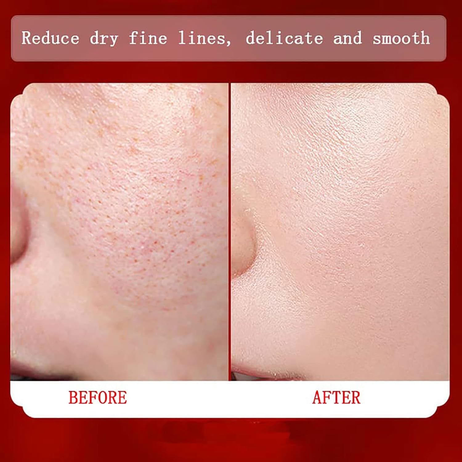 Crema de sangre de dragón real de placenta de retinol, crema de sangre de dragón real de placenta, crema hidratante facial de retinol, crema facial