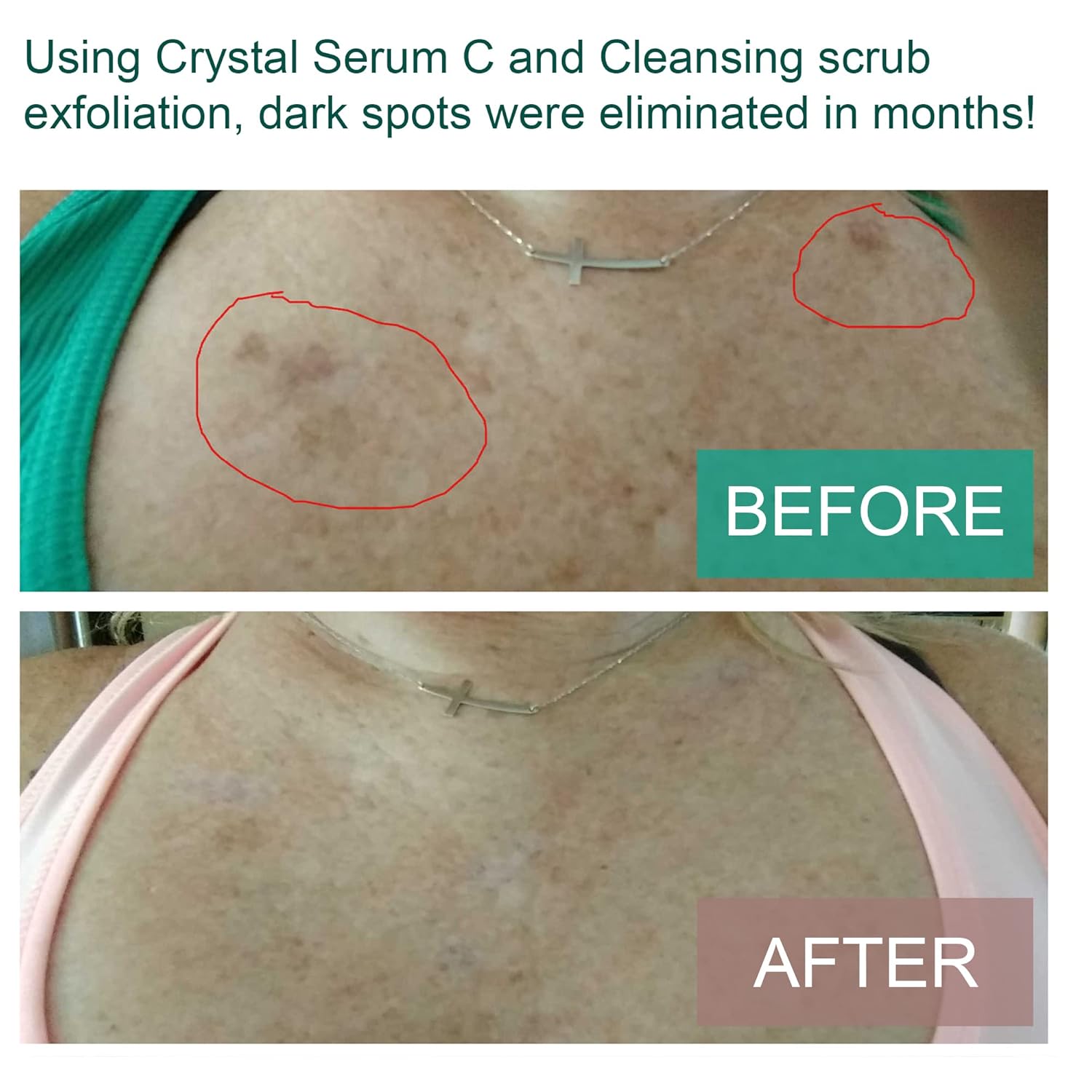 Carolyn’s Facial Formulas Crystal Serum C, paquete de 3  Suero de vitamina C  Suero para limpiar la piel  Fabricado en Estados Unidos  Orgánico,
