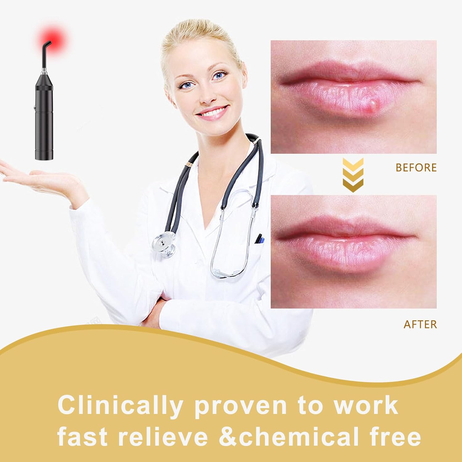 Dispositivo de luz roja para herpes labial, dispositivo de luz roja para boca, nariz, oído, rodilla, manos, músculo, articulaciones, dispositivo