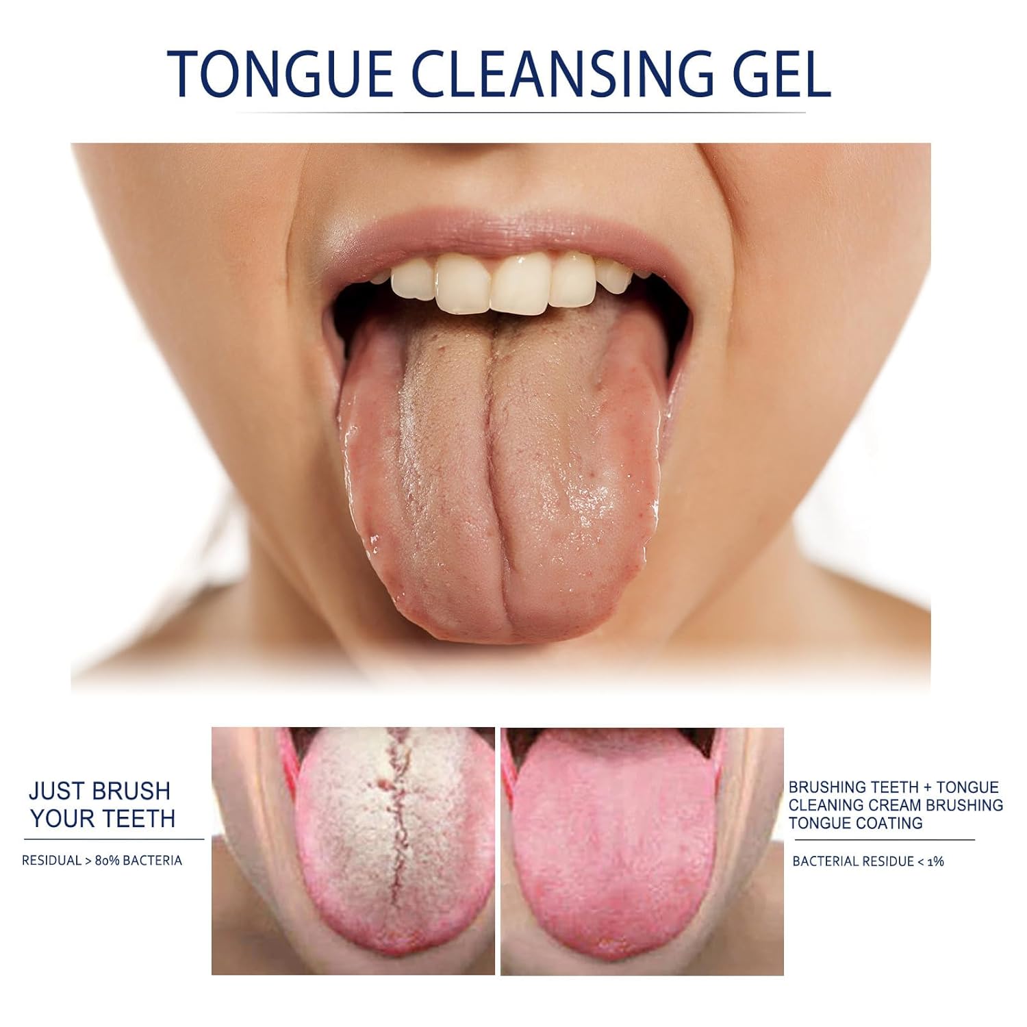 Juego de gel limpiador de lengua, gel limpiador de lengua con cepillo de lengua, raspador de lengua para adultos y niños con gel de limpieza, fácil