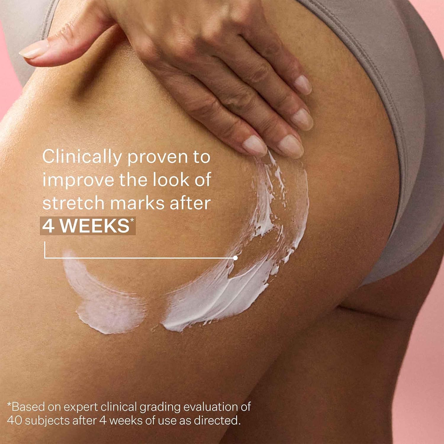 StriVectin SD Advanced Plus – Hidratante intensivo para arrugas y estrías, para rostro y cuerpo, estimulante de colágeno con péptidos y ácido