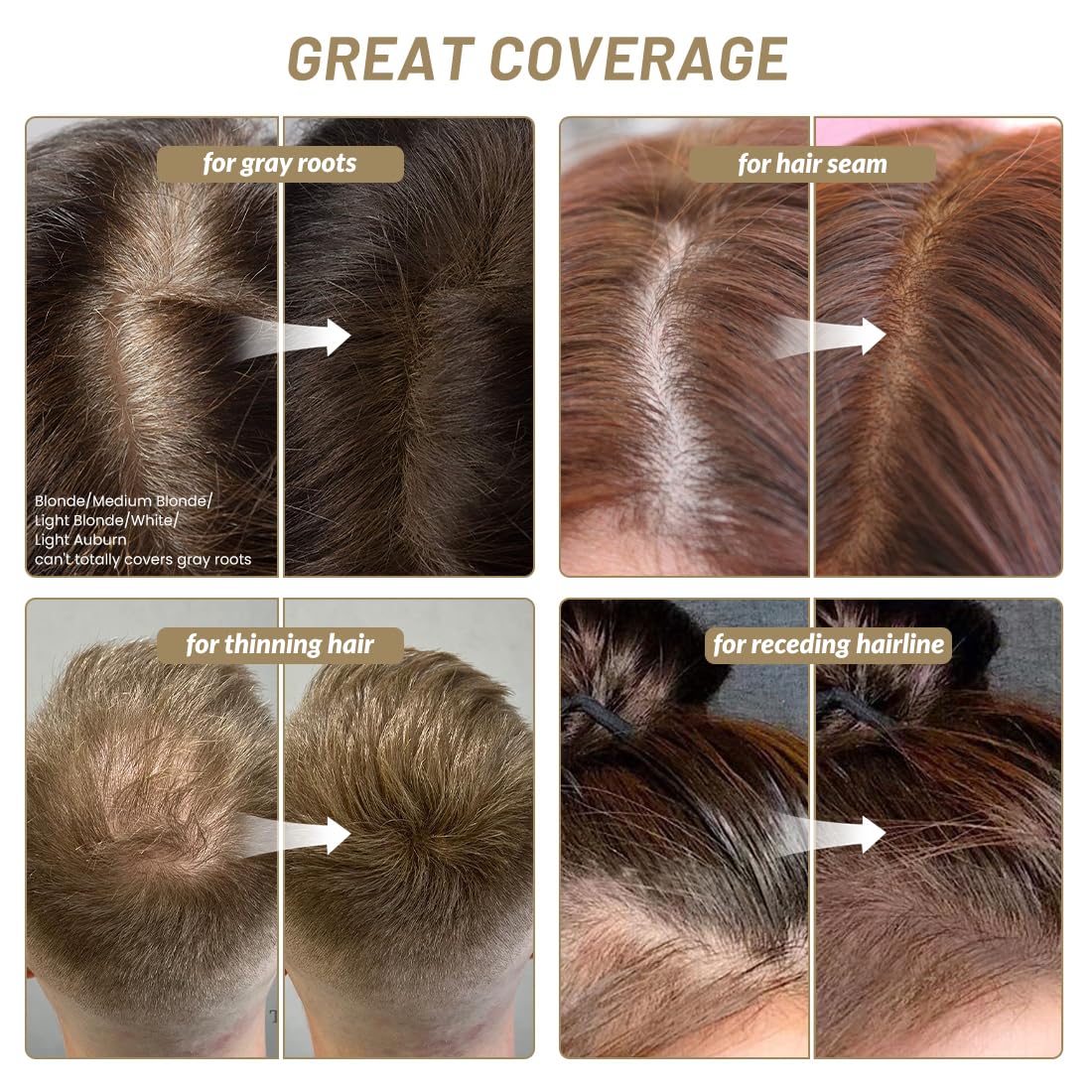 SOVONCARE Polvo instantáneo de línea de cabello, sombra de línea de cabello, cobertura de cabello gris, polvo de retoque de cabello para cabello