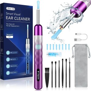 Eliminación de cera de oído, cámara de oído con 1440P HD, limpiador de oídos con cámara WiFi integrada, kit de eliminación de cera con 6 púas de Eliminación de cera de oído, cámara de oído con 1440P HD, limpiador de oídos con cámara WiFi integrada, kit de eliminación de cera con 6 púas de