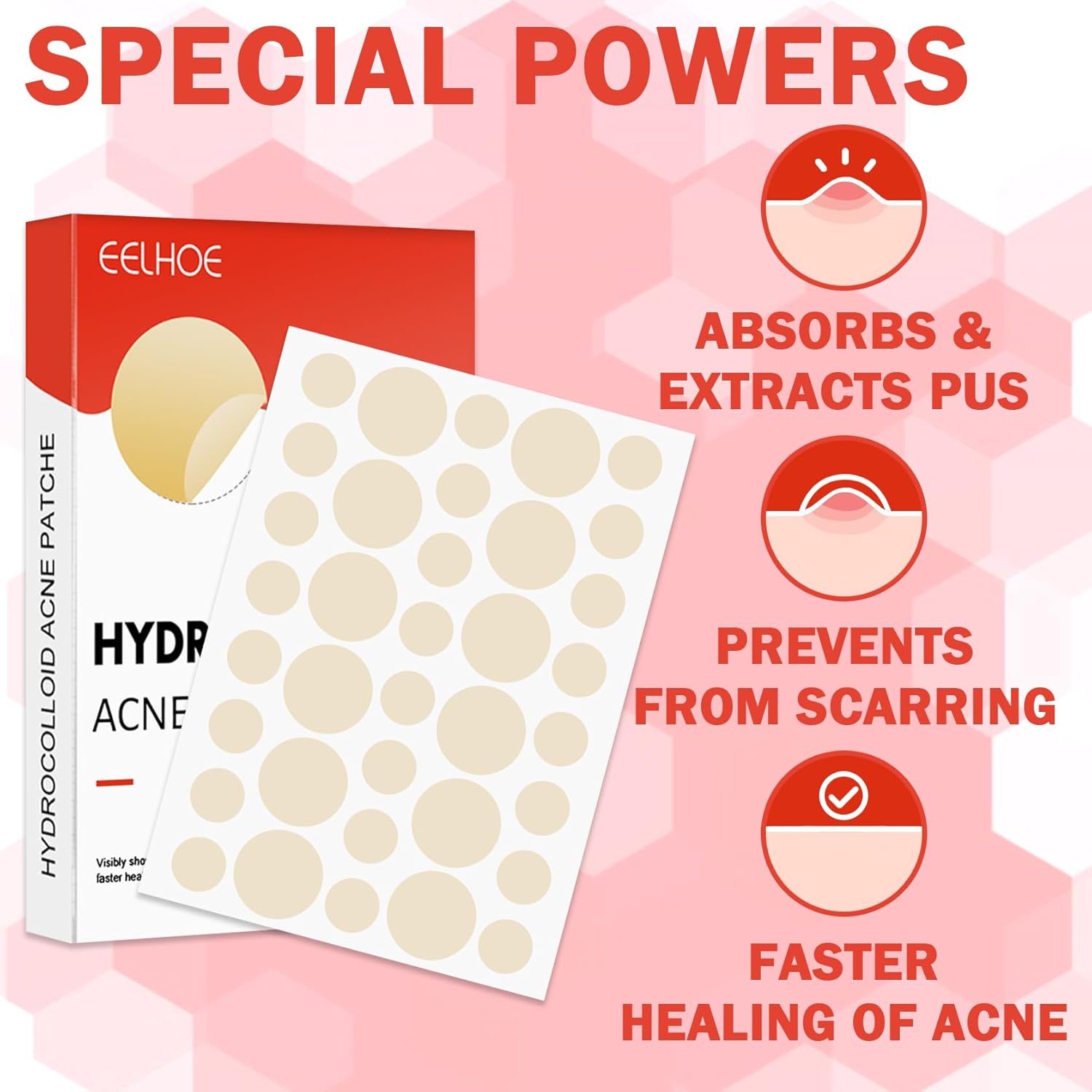 Parches hidrocoloides para cubrir el acné, parche de espinillas para acné, parches hidrocoloides para absorber el acné, calcomanías curativas para