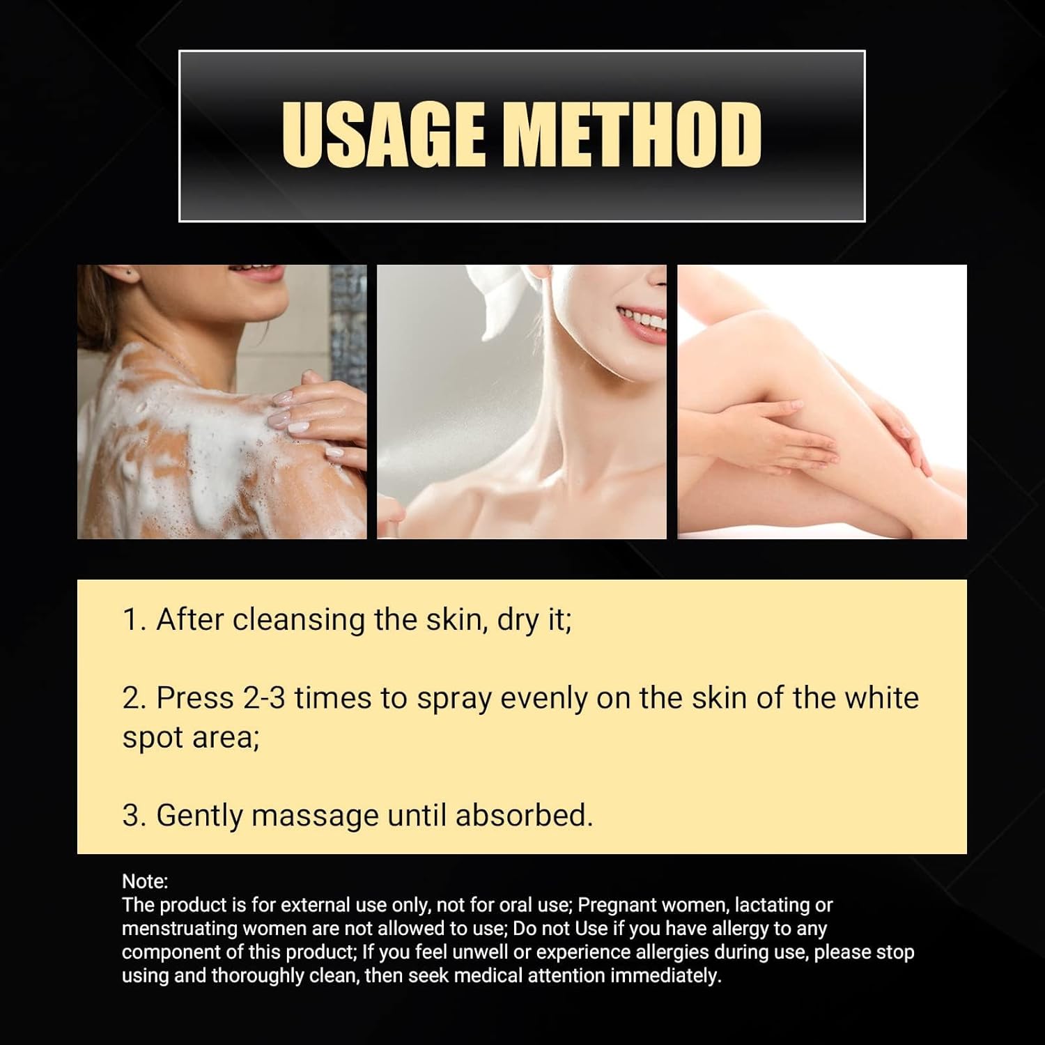 NYYQYYN EELHOE – Spray de alivio de vitiligo de manchas blancas, spray de reparación de la piel de vitiligo, spray para el cuidado de la piel,