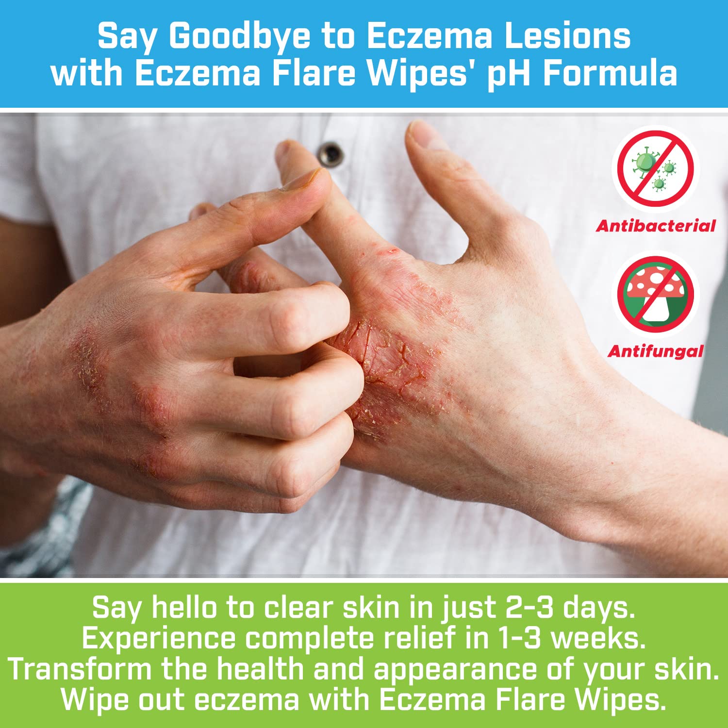 Eczema Flare Wipes – Alivio del eccema de acción rápida totalmente natural, antipicazón, reduce la inflamación y protege la barrera de la piel,