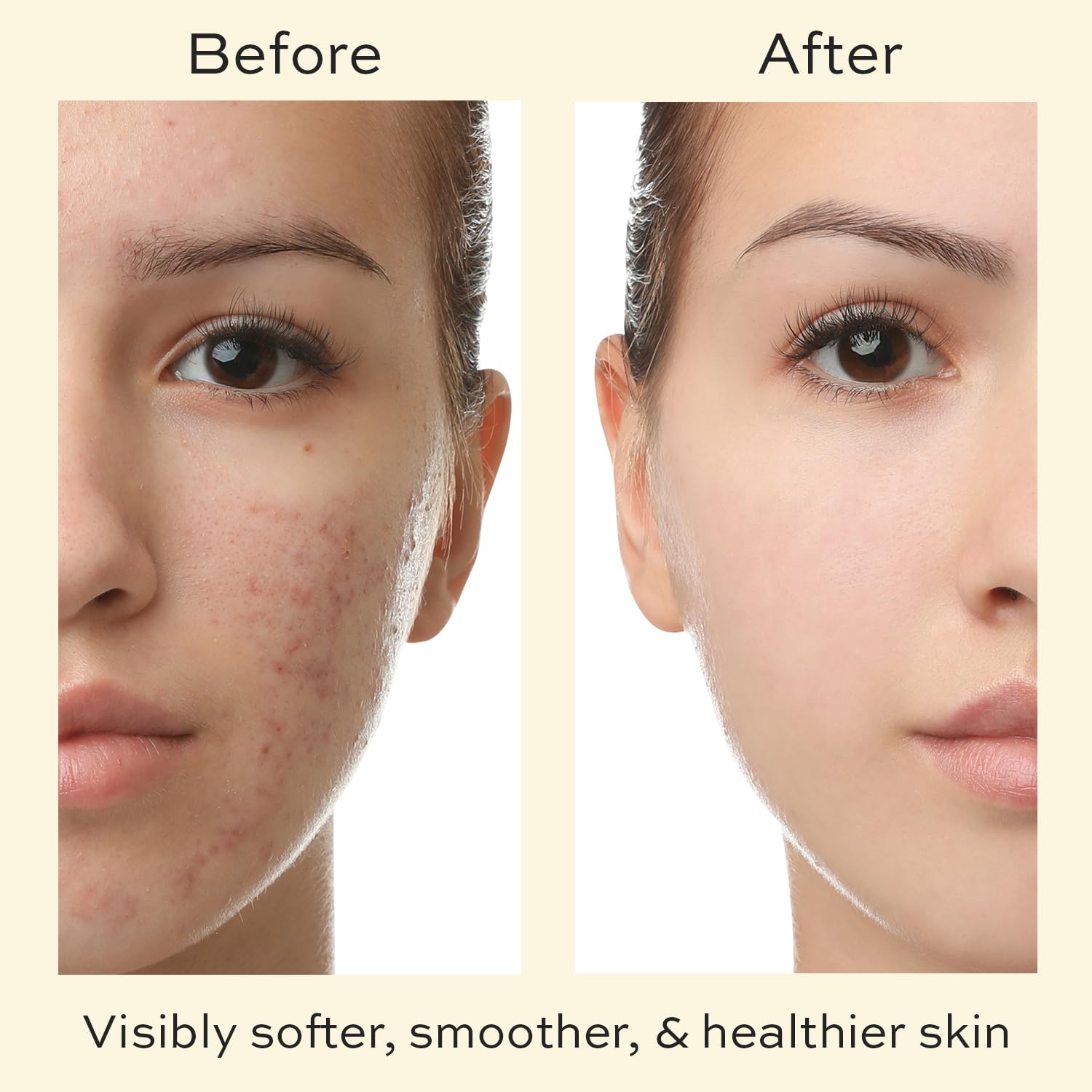 Crema facial para adolescentes y niños – Hidratante facial orgánico para piel seca – Crema facial calmante con crema hidratante de árbol de té –