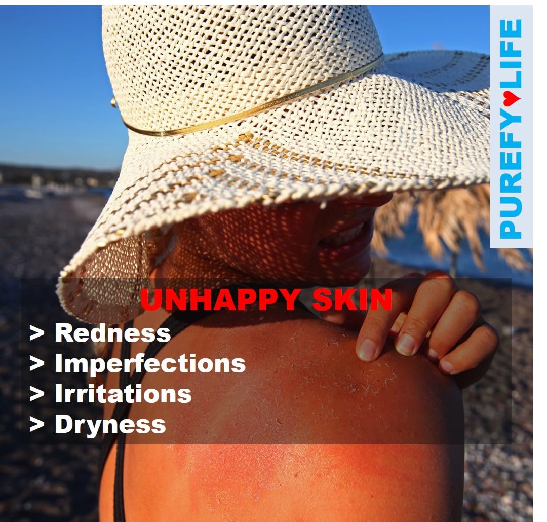 Spray tópico (3.4 onzas) calmante para la cara y el cuerpo, tecnología Purefypro Dermal HOCL, soporte natural para el cuidado de la piel,