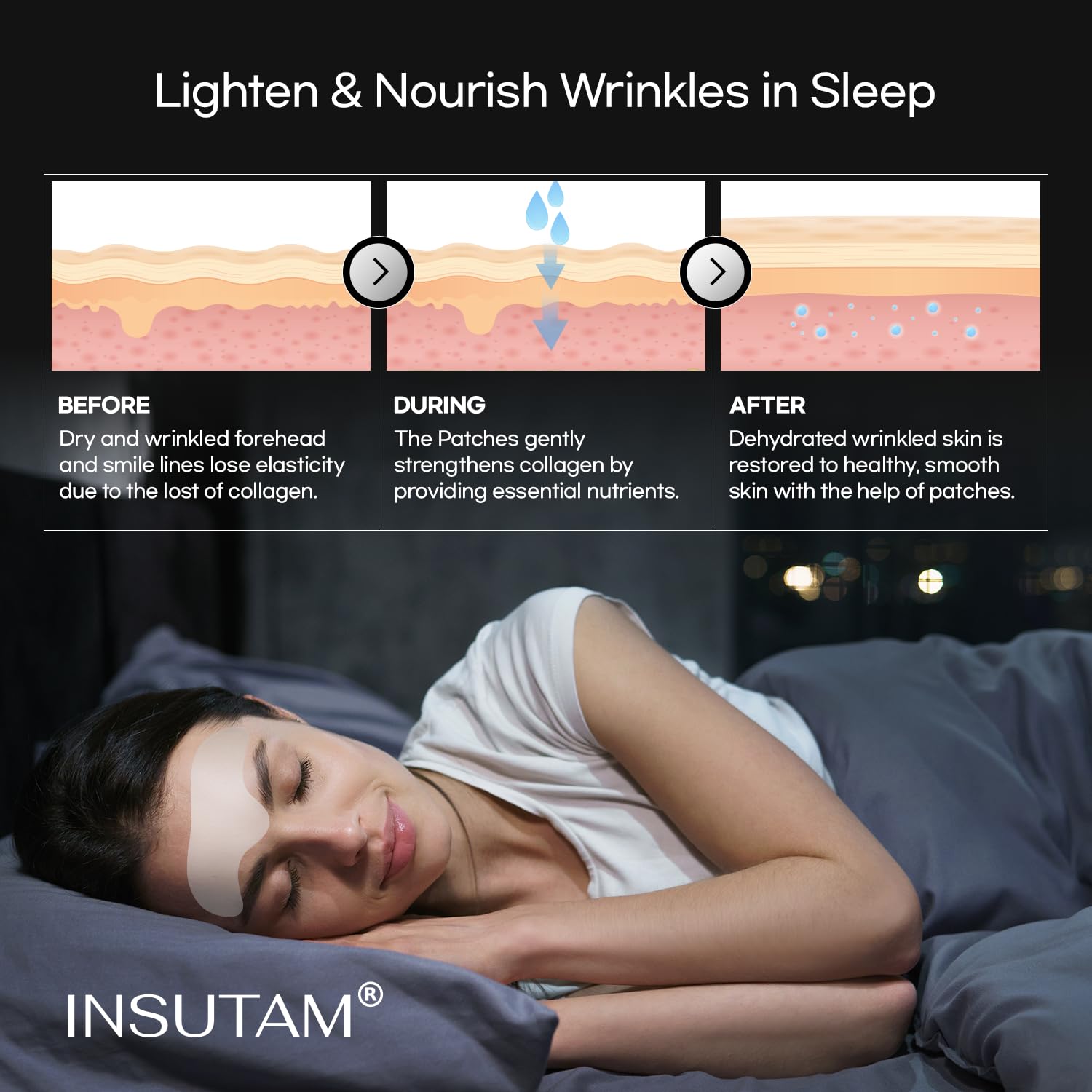 Insutam Parches antiarrugas para la frente para antiarrugas Almohadillas removedoras de líneas de sonrisa – Tratamiento de líneas de elevación