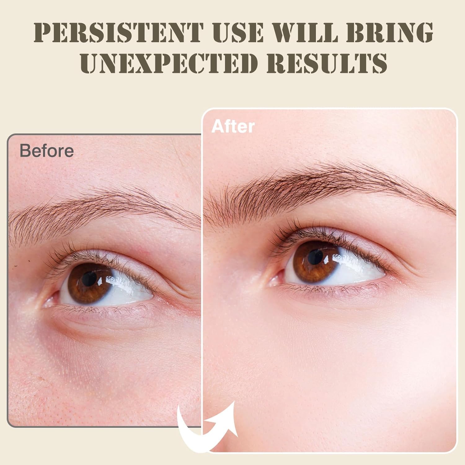 Parches debajo de los ojos para ojeras y ojos hinchados, (60 unidades de oro de 24 quilates), máscaras para el cuidado de la piel, parches
