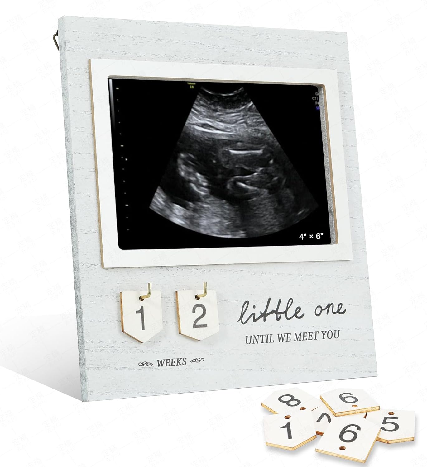 Marco de fotos con ultrasonido de cuenta regresiva para bebés, regalo de embarazo para futuros padres, regalos de anuncio de bebé, marco de fotos de