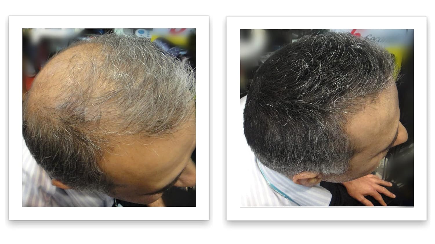 Tamaño de prueba elimina el punto calvo y el adelgazamiento del cabello al instante. Haz que el cabello fino se vea 10 veces más lleno. Fibra