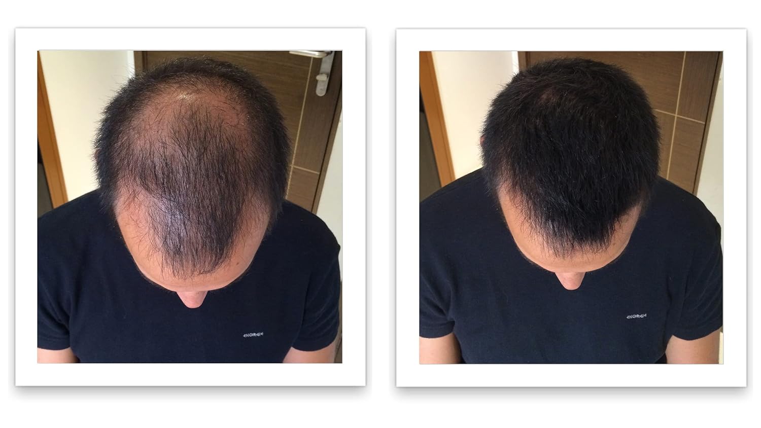 Oculta puntos calvos y bordes calvos al instante. Haz que el cabello fino se vea 10 veces más lleno. Kit de inicio de fibra capilar Caboki (negro)