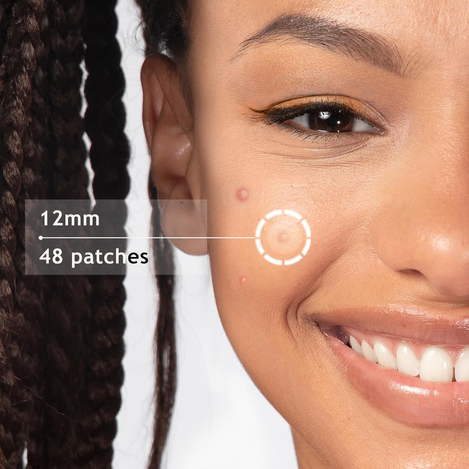 Parches de espinillas ultra  Parche hidrocoloide para el acné para cubrir zits e imperfecciones, brotes de acné, calcomanías para puntos de acné