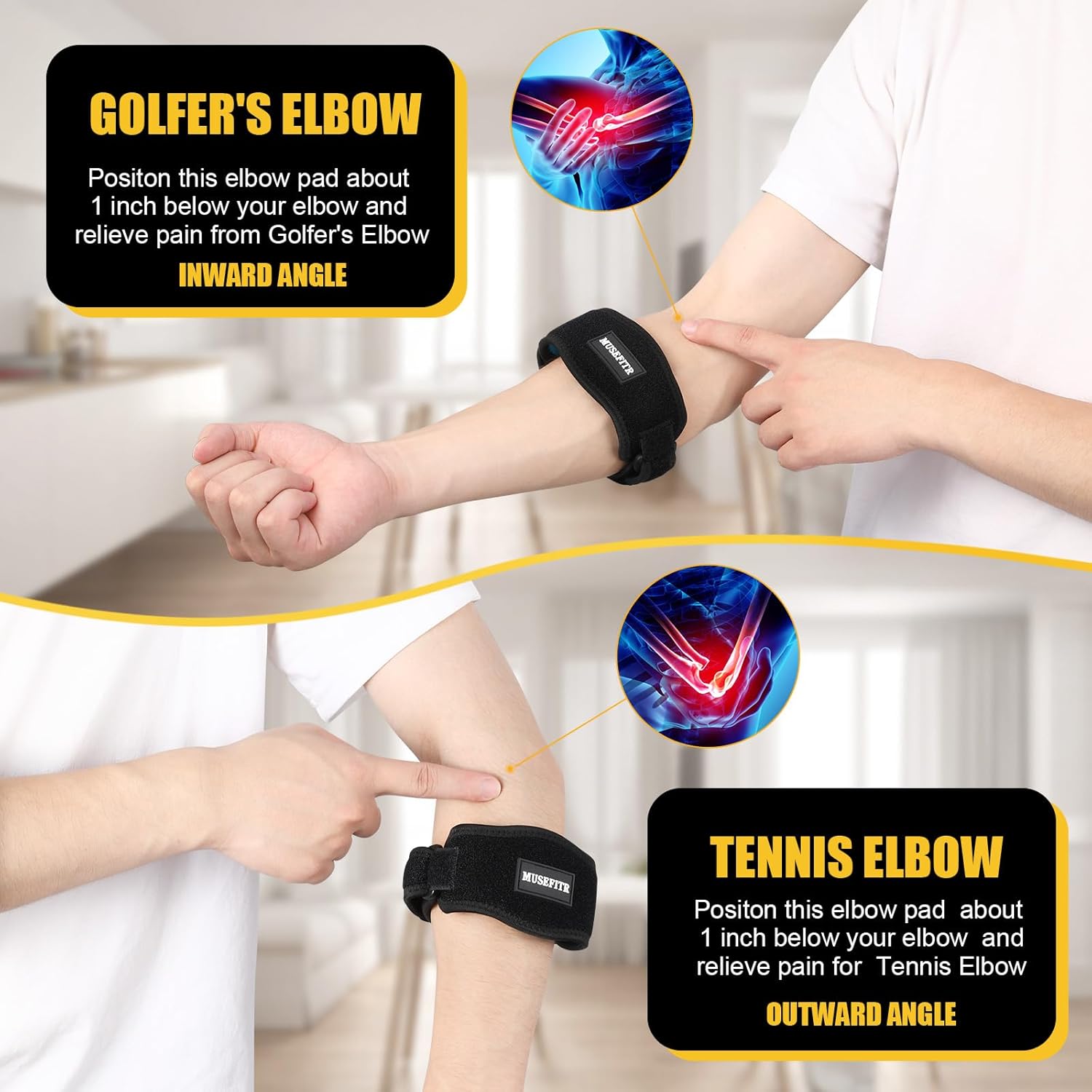 Paquete de 2 coderas para tendinitis y codo de tenista, soporte de codo para mujeres y hombres, alivio del dolor de codo y recuperación, color rojo