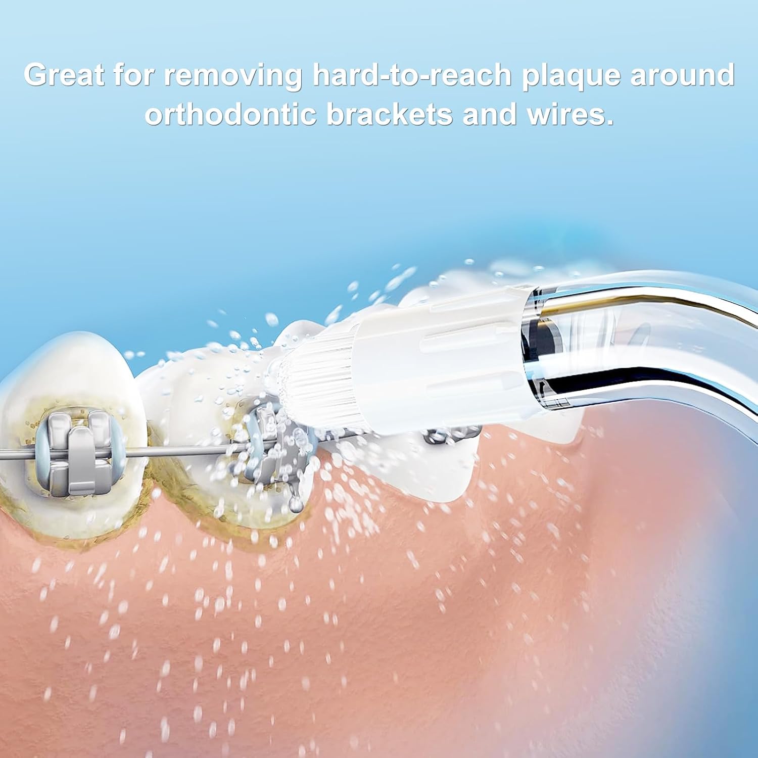 Puntas de repuesto para irrigadores de agua Waterpik, puntas de ortodoncia de repuesto compatibles con irrigadores de agua Waterpik y otros