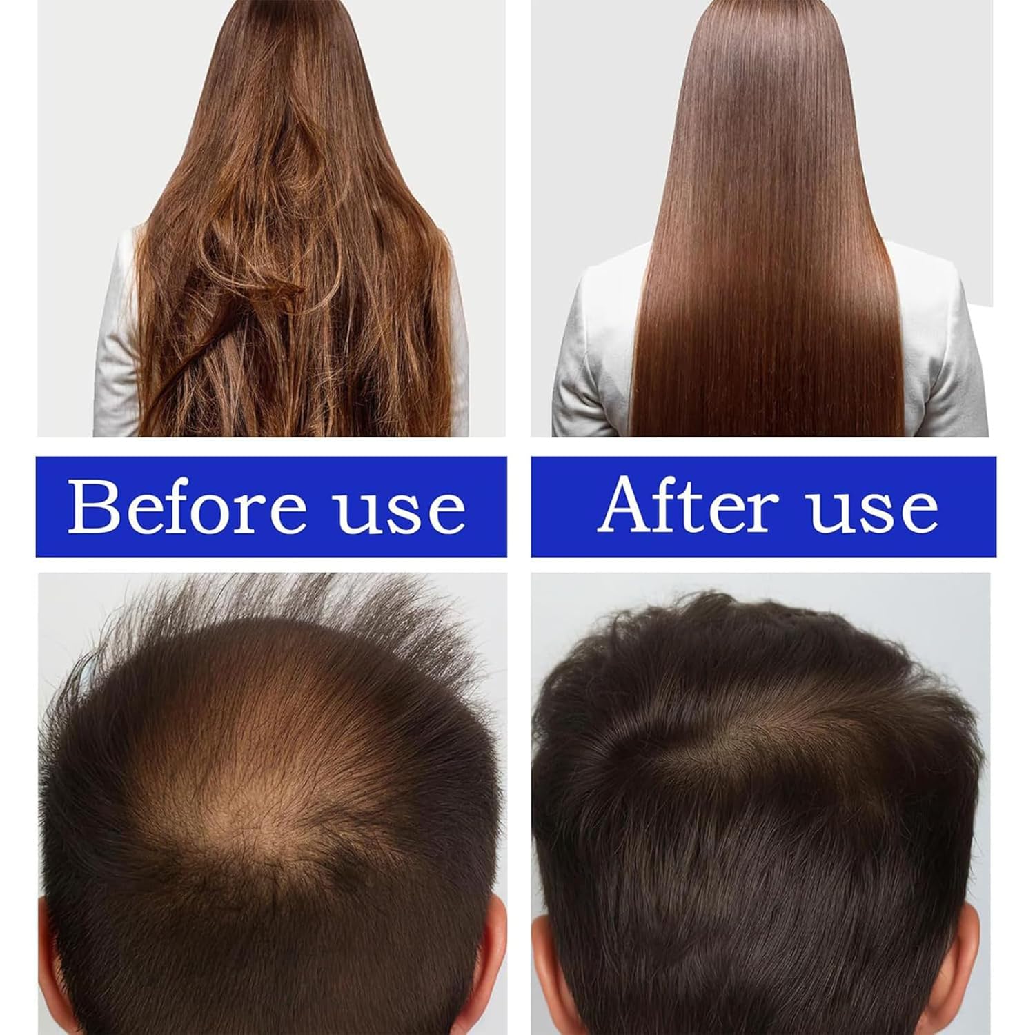 Aceite de batana crudo para el crecimiento del cabello, 100% aceite de batana orgánico para el crecimiento del cabello, aceite de batana de
