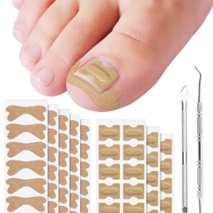 Herramienta de tratamiento de corrección de uñas encarnadas, 60 parches correctores de uñas encarnadas en 2 tipos, herramienta profesional segura Herramienta de tratamiento de corrección de uñas encarnadas, 60 parches correctores de uñas encarnadas en 2 tipos, herramienta profesional segura