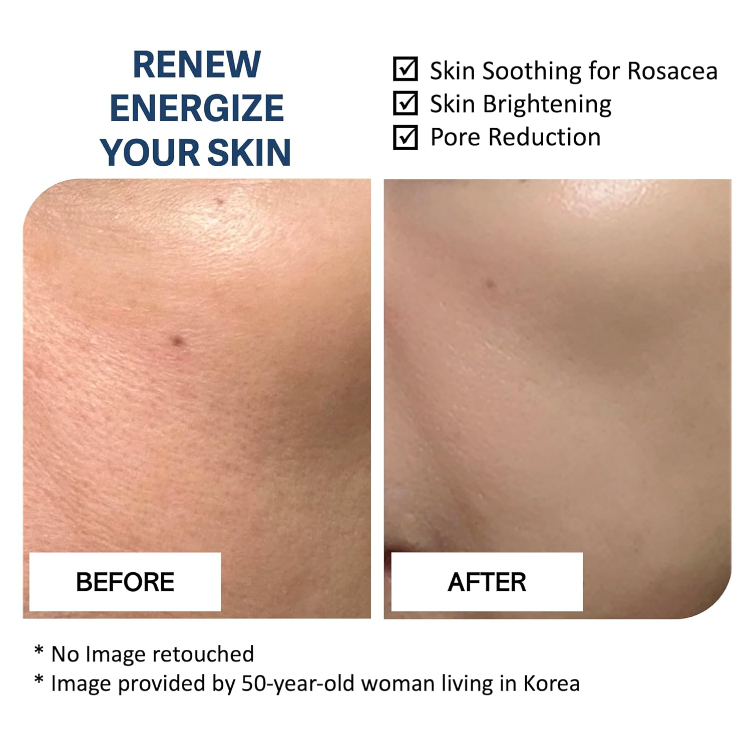 Mascarilla coreana de arroz con ácido hialurónico, iluminadora, calmante, refrescante, antienvejecimiento e hidratante, mascarilla facial coreana de