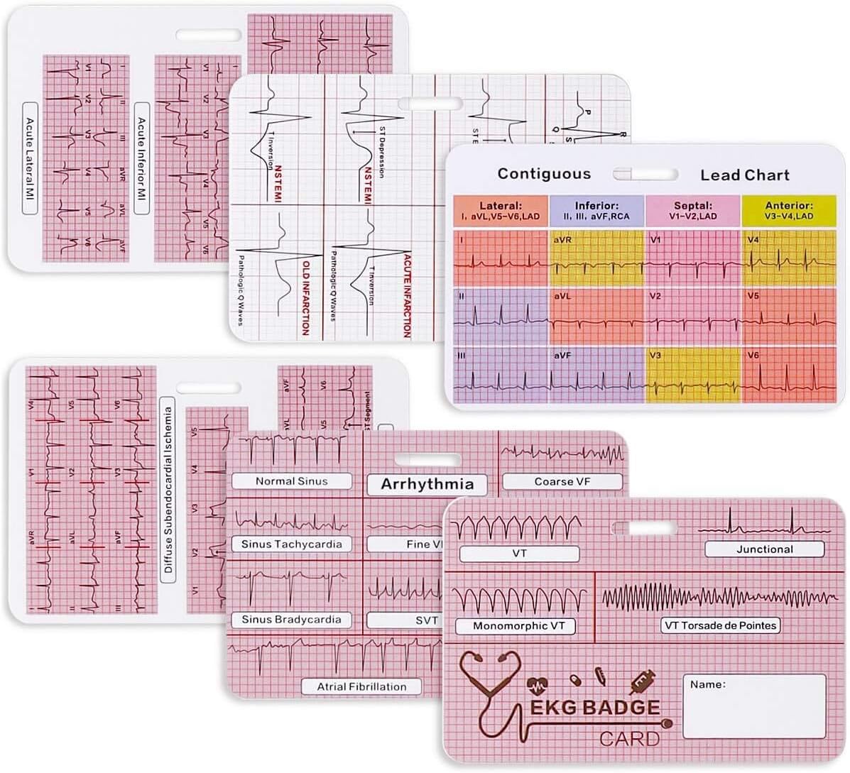 EKG – Juego de 3 tarjetas de identificación cardíaca, tarjeta de identificación Stemi, tarjeta de interpretación de telemetría de ECG, amigo de