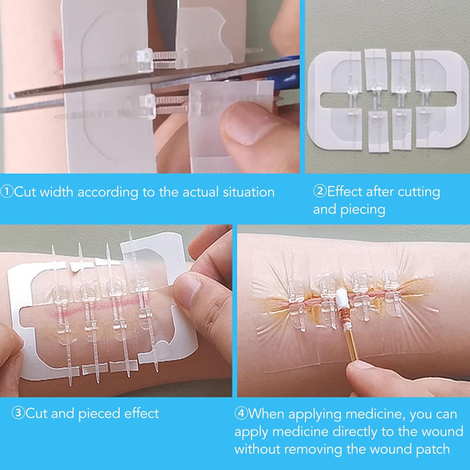 Dispositivo de cierre de heridas con puntada de cremallera, kit de laceración de 2 piezas, vendas Steri Strip Bandaids reparación de laceración