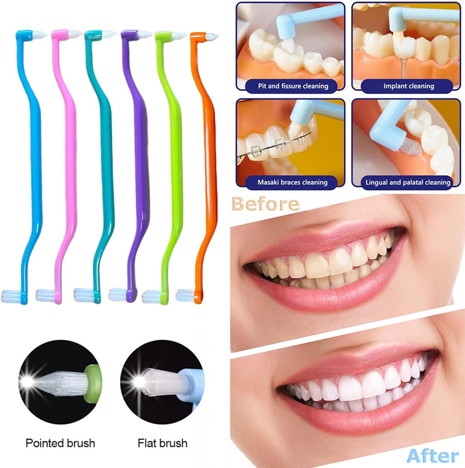 Jrehoor Cepillos interdentales, 6 piezas 2 en 1 cepillo de dientes suaves con cabezales de cepillo de dientes interdentales y de sabiduría para un