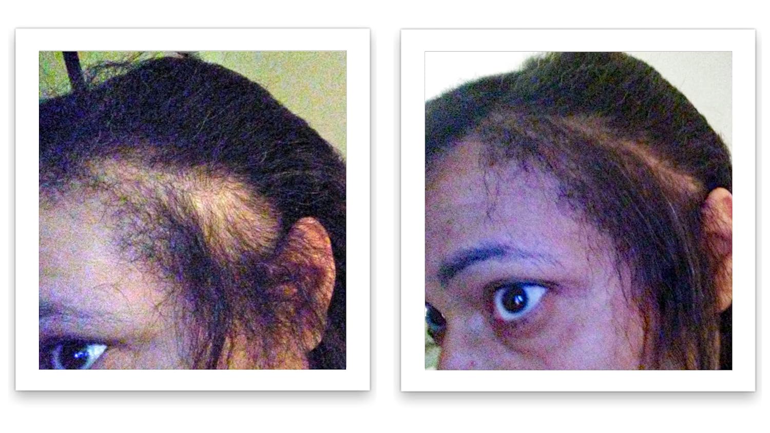 Oculta puntos calvos y bordes calvos al instante. Haz que el cabello fino se vea 10 veces más lleno. Kit de inicio de fibra capilar Caboki (negro)