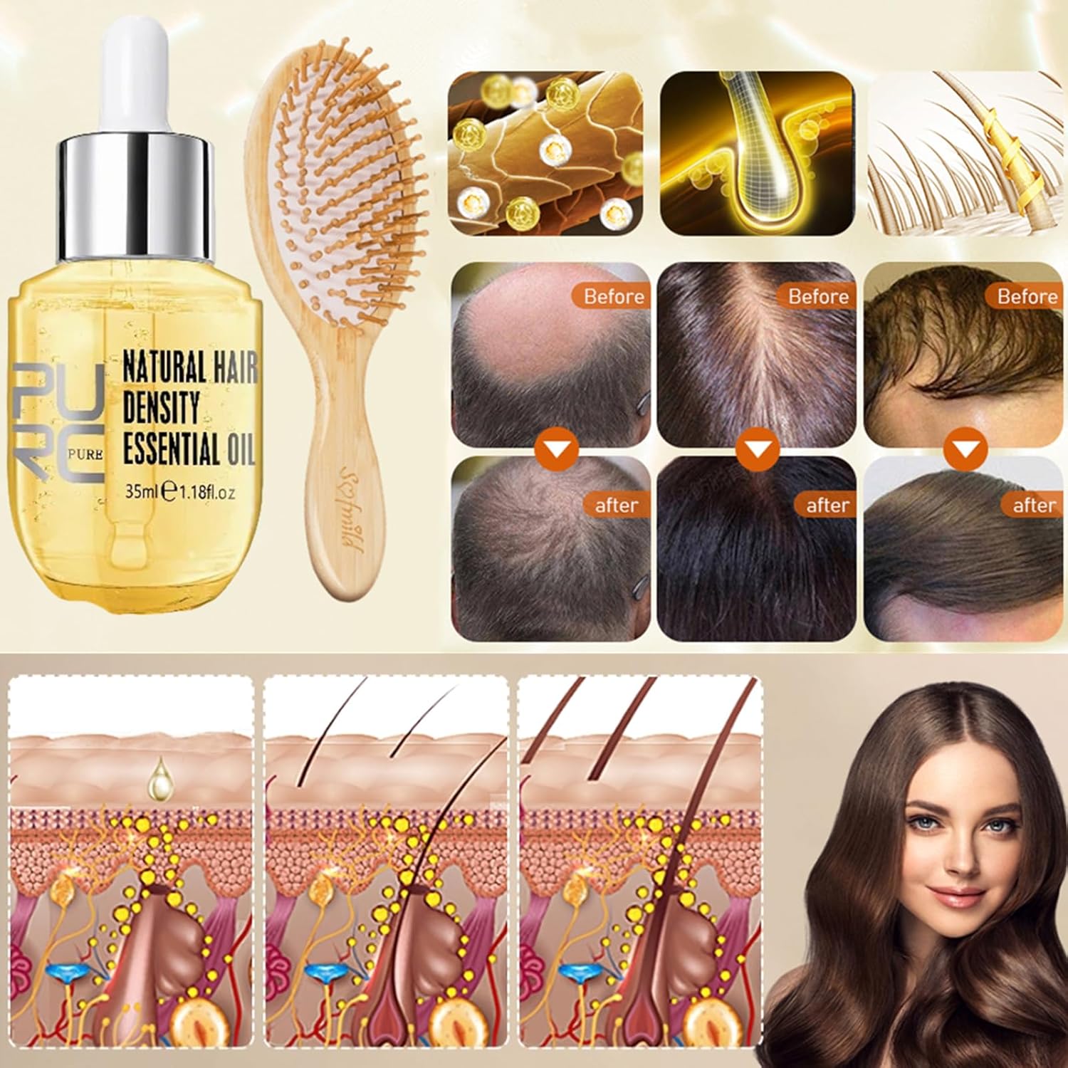 Sofmild Aceite esencial para el crecimiento del cabello, juego de cepillos para el cabello con suero para el crecimiento del cabello para cabello