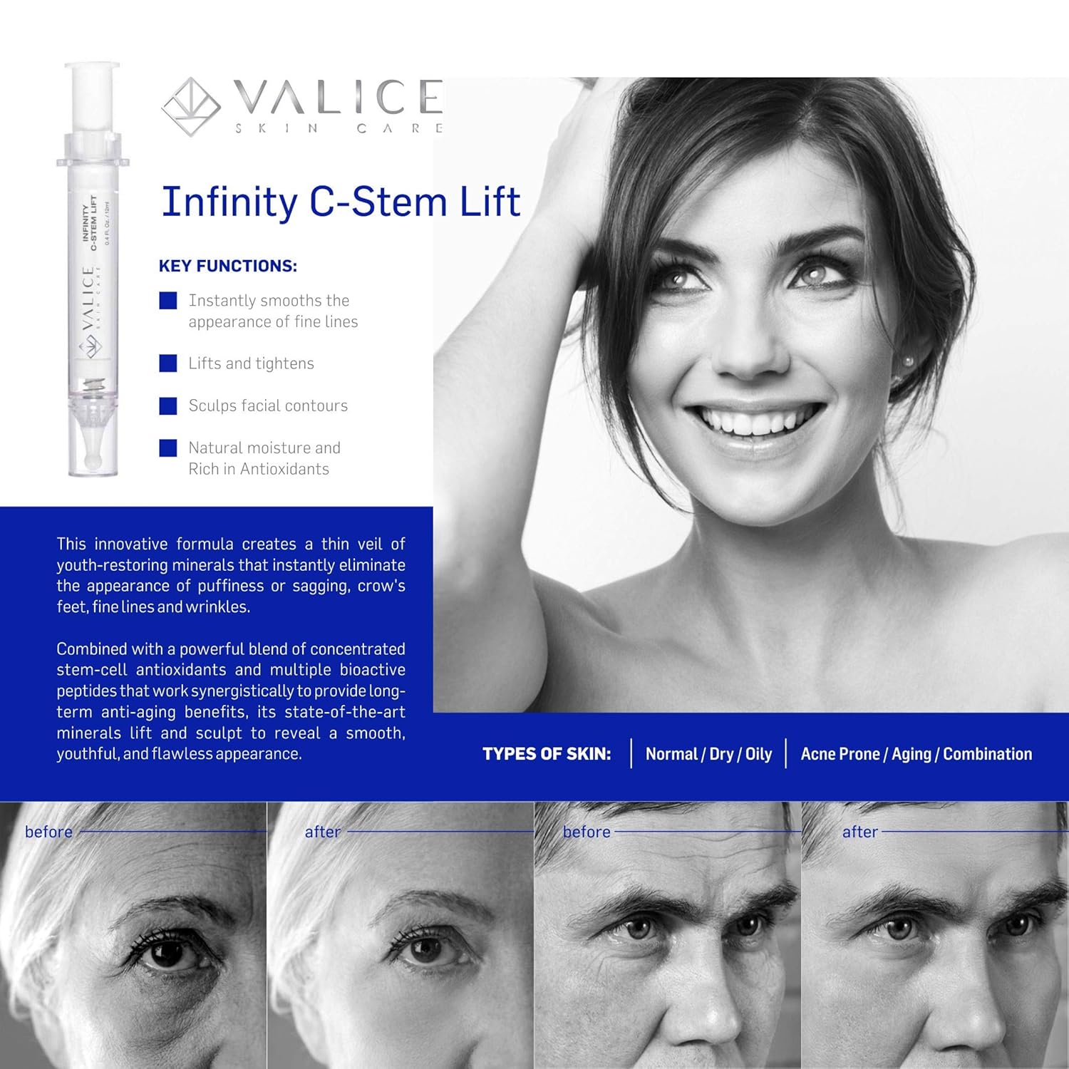 Valice Infinity C Stem – Micro suero de elevación instantánea hecho con células madre vegetales, funciona para reducir visiblemente las bolsas y