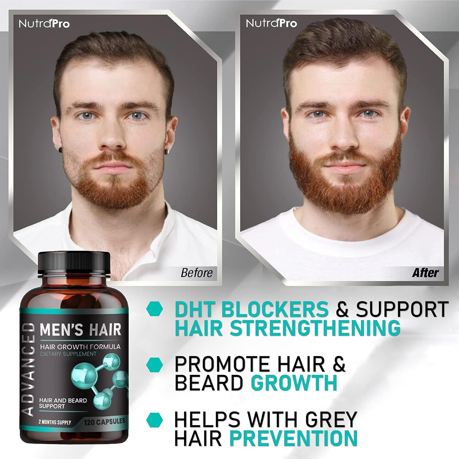Vitaminas para el crecimiento del cabello para hombres, píldoras contra la pérdida de cabello. Suplemento para el crecimiento del cabello y el