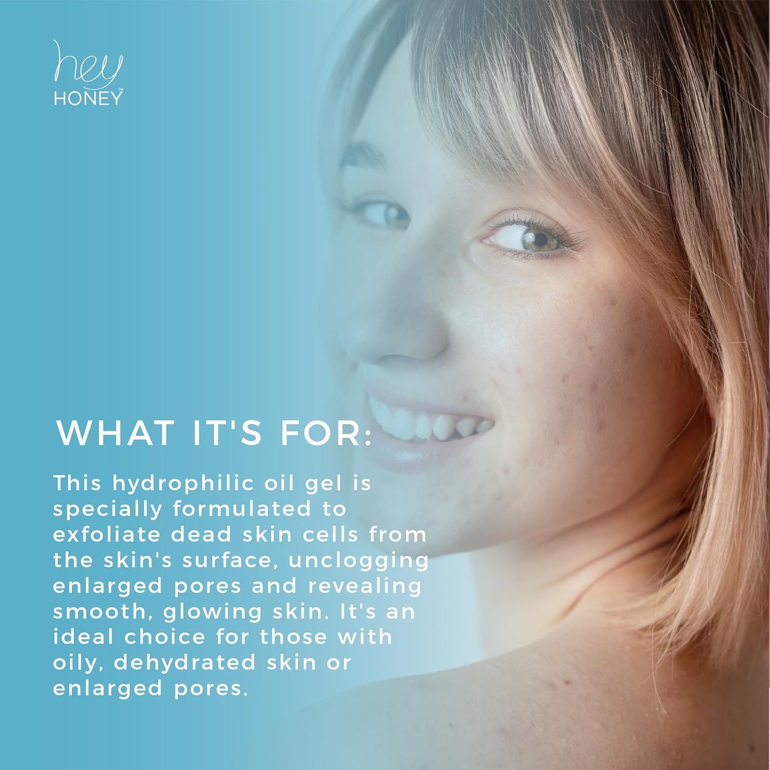 Hey Honey Skincare Be Clear – Gel limpiador de poros profundos para el control del acné  Propóleos, aceite de té verde, camelia, exfolia,