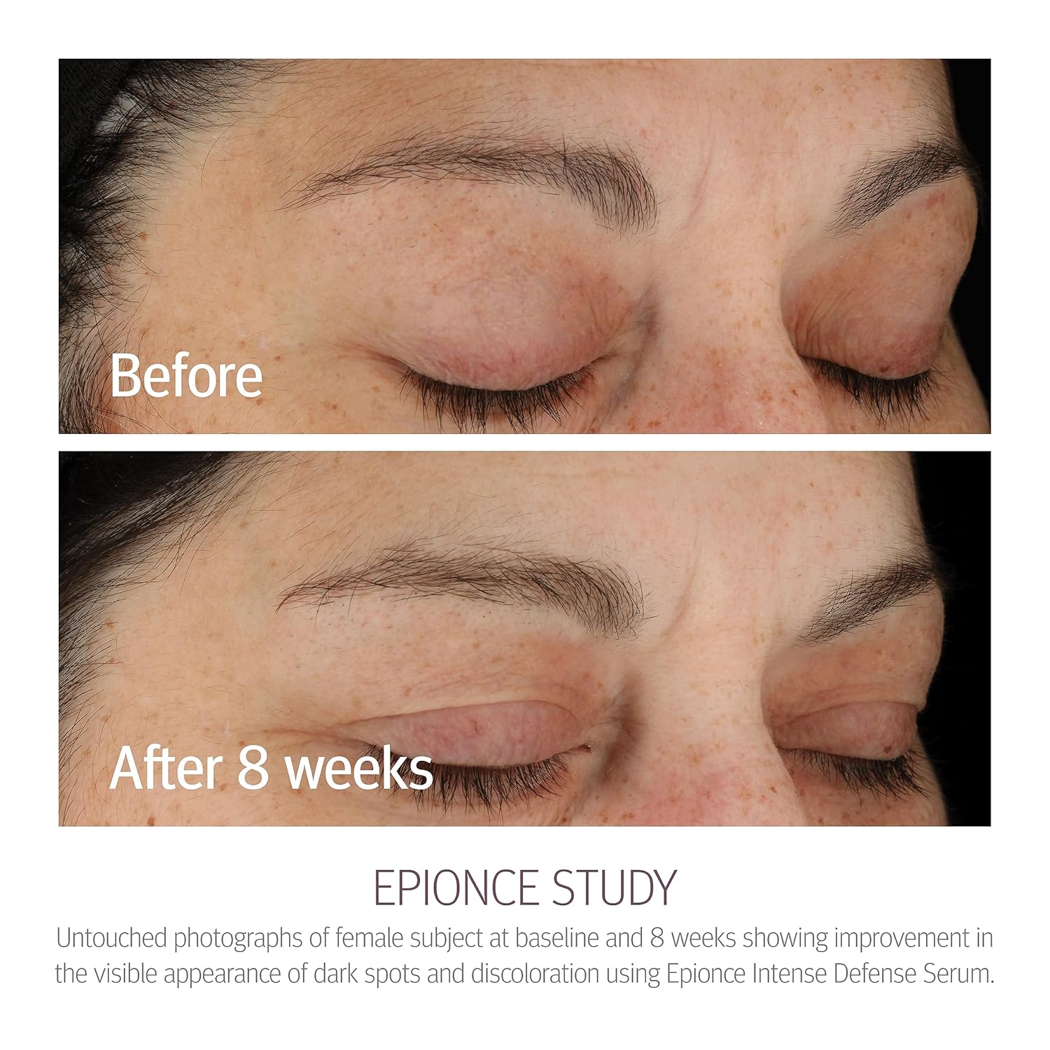 Epionce Intense Defense Serum – Anti Aging Serum for Face Anti Aging, Brightening Serum with Vitamin C, Vitamin E, Vitamin D, A, B, Niacinamide Serum