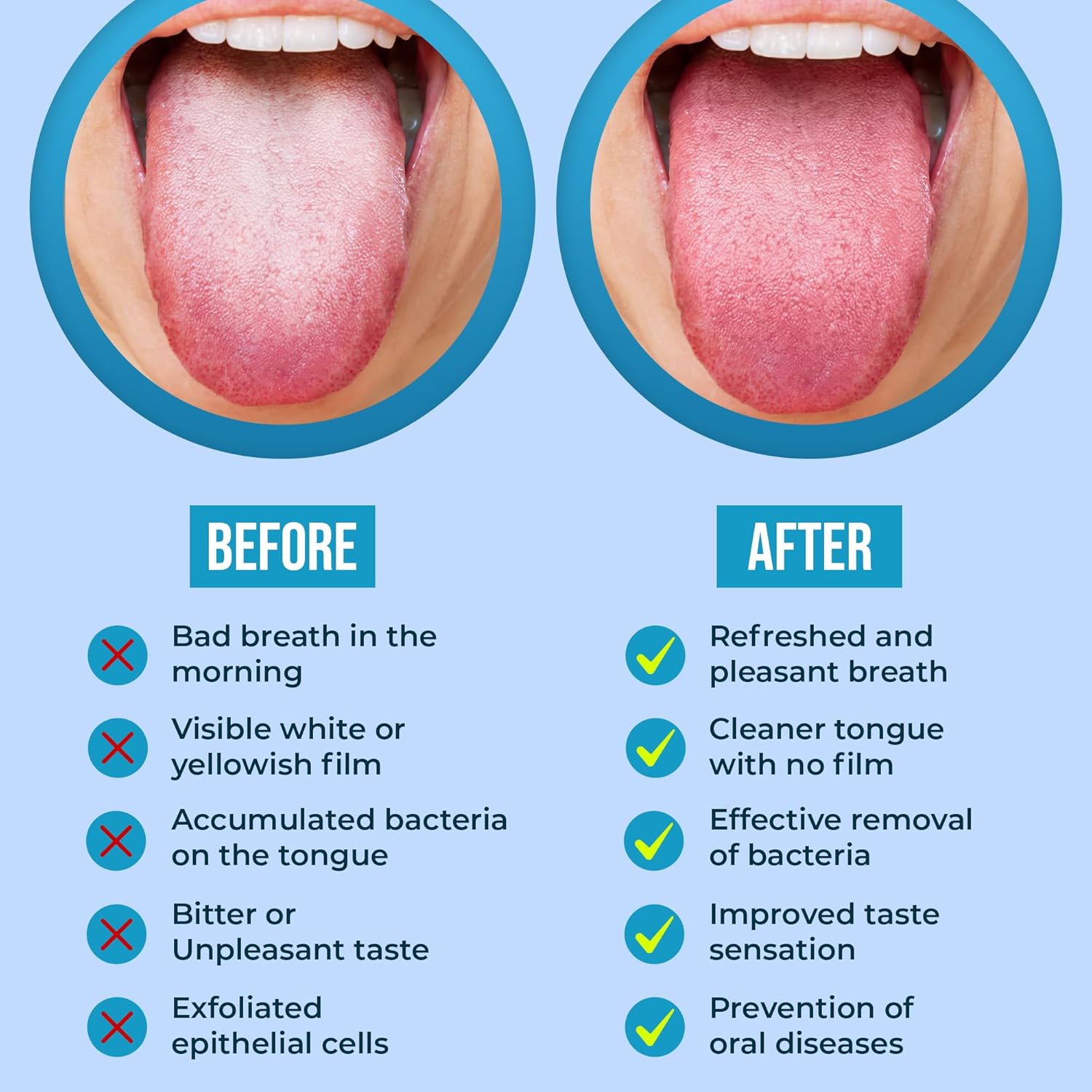 AARAM Limpiador de lengua, rascador de lengua que cura el mal aliento, limpiadores de lengua de acero inoxidable, material libre de BPA, raspadores