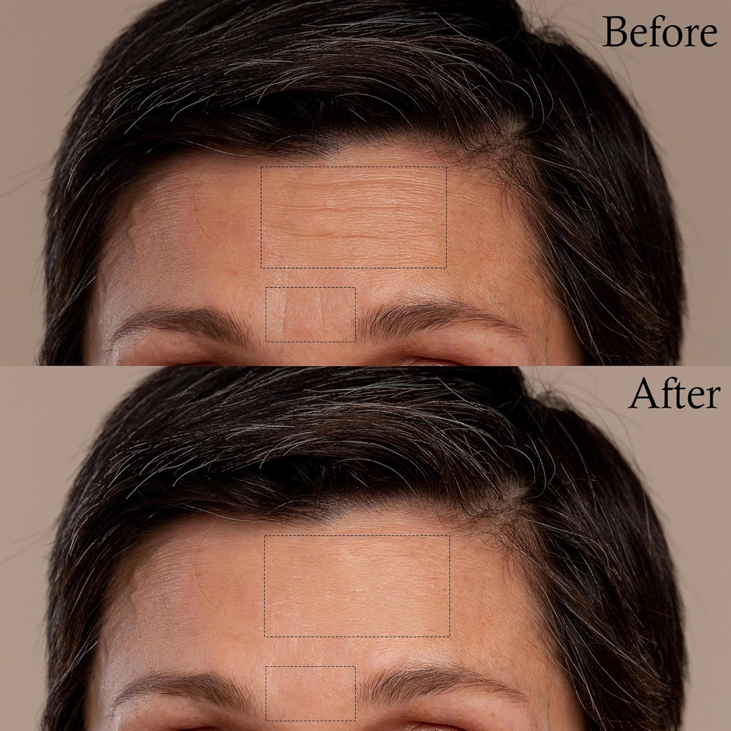 Cara, arrugas de ojos, parches de arrugas en la frente para la cara durante la noche – 72 piezas