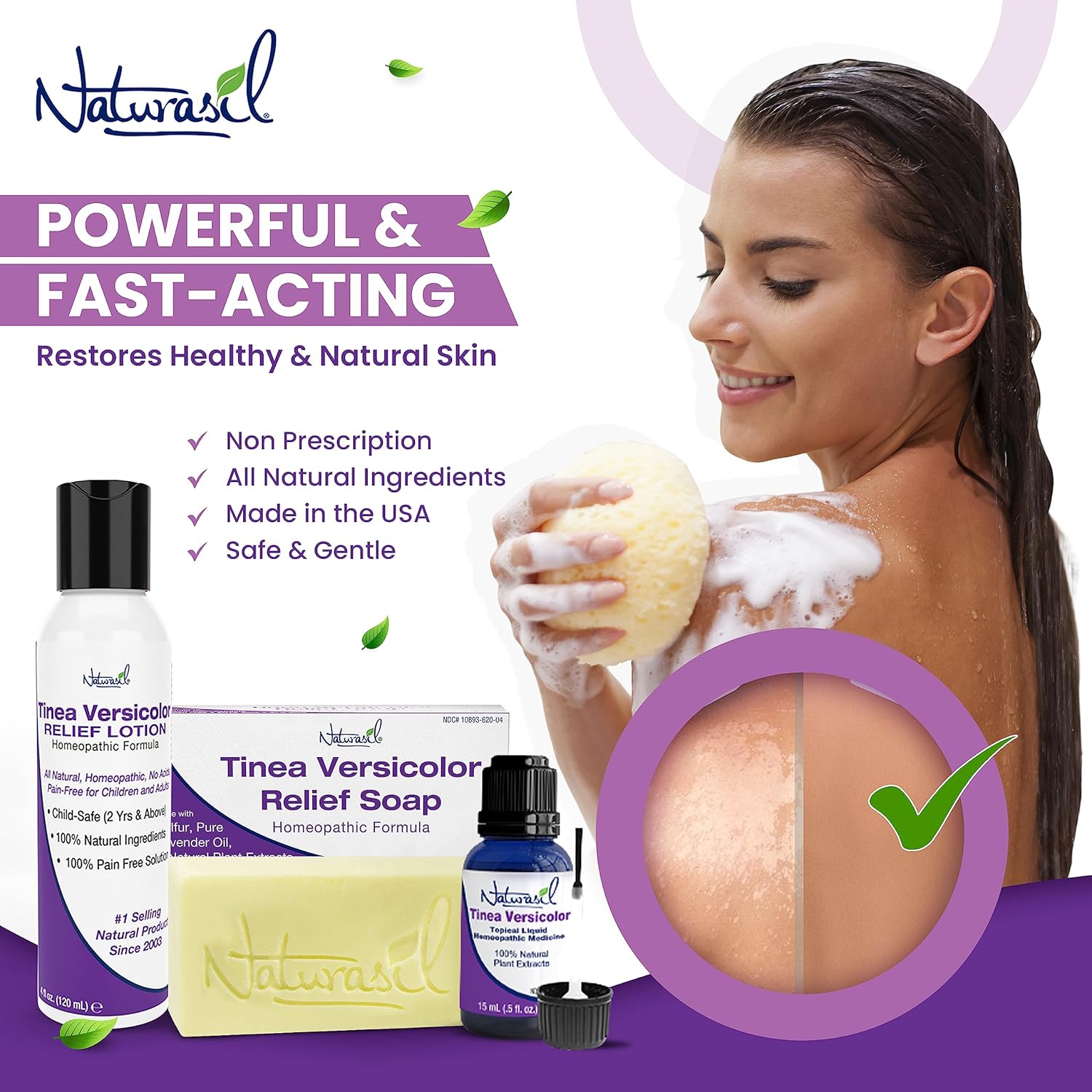 Naturasil Natural Treatment Tinea Versicolor - Jabón 10 de azufre También ayuda a aliviar la candida y la onicomicosis Barra de 4 onzas Paquete - Imagen 4